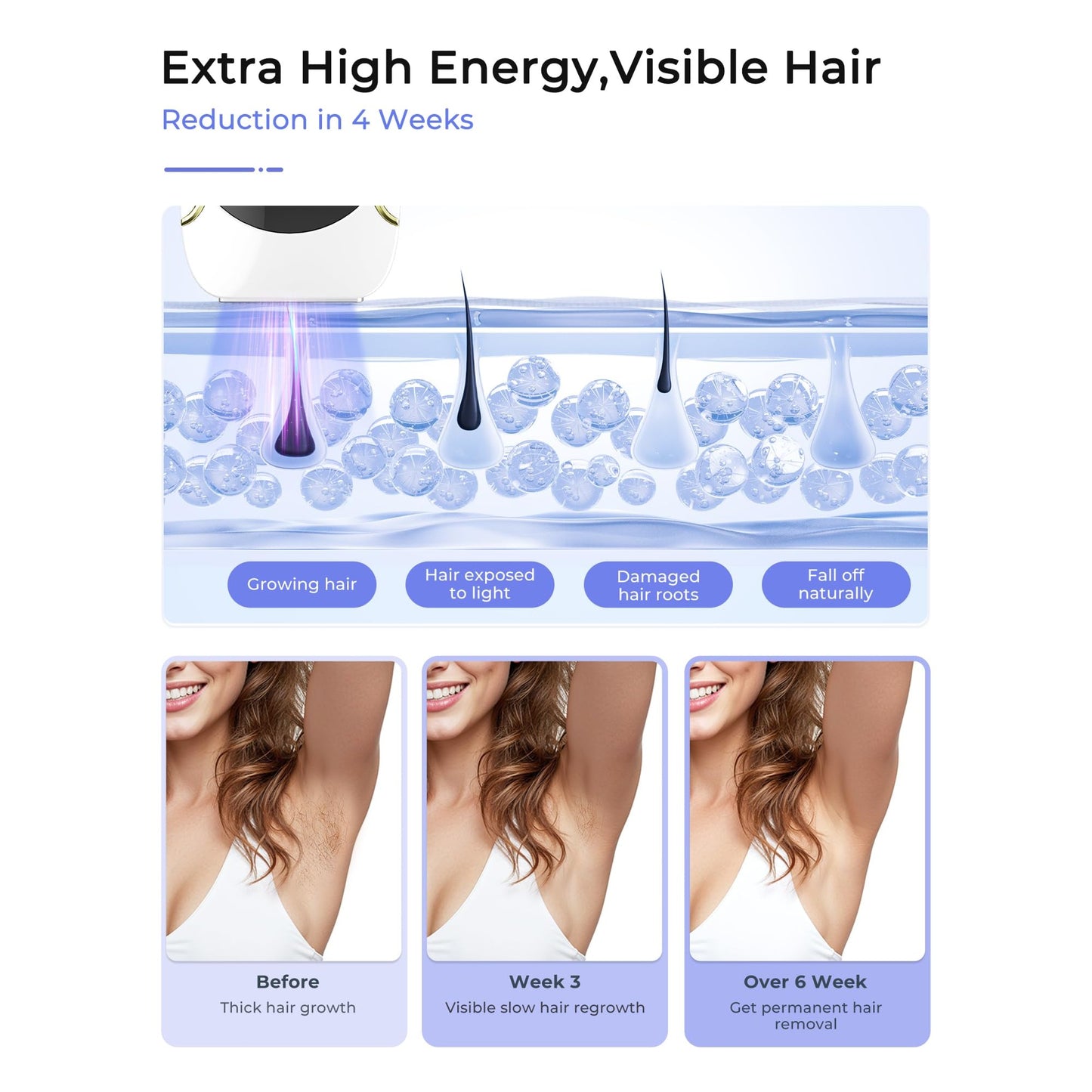 Finequin Laser Hair Removal for Women and Men, Air 15 Ice-cooling IPL Device Hair Removal for Nearly Painless & Long-Lasting Results From Home, 3 Modes & Auto Flashing for Fast Full Body Hair Removal - Medaid International