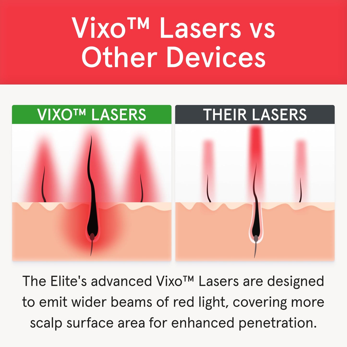iRestore Elite - Laser Red Light Therapy for Hair Growth System - FDA Cleared Hair Loss, Hair Thinning & Alopecia Treatment for Men & Women - Laser Cap for Hair Regrowth Stimulates Denser Fuller Hair - Medaid International