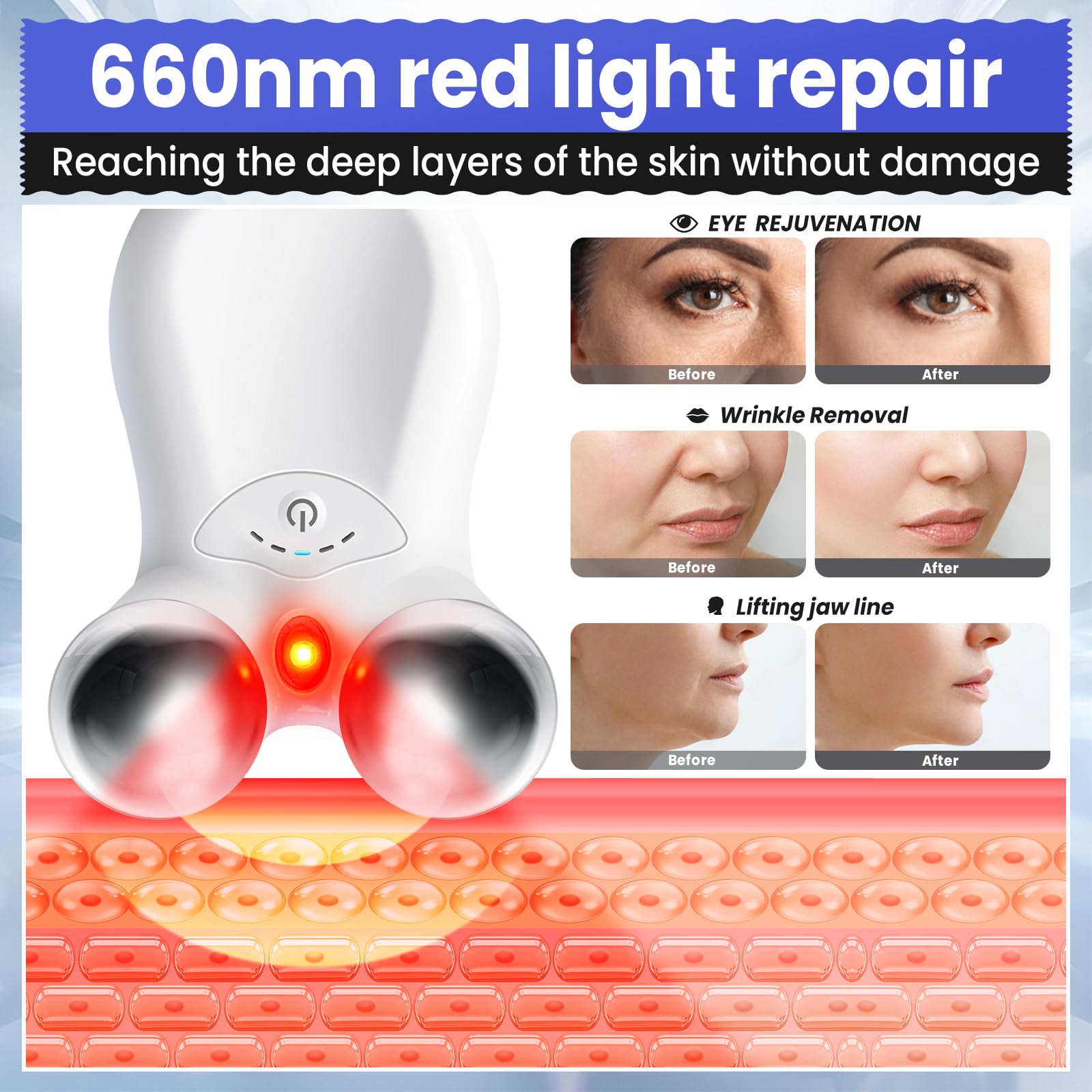 Gunfay Microcurrent Facial Device,Latest Red Light Technology,Enhances The Ability to Lift The Face and Tighten The Skin,USB Red Light Device for Face,for Facial Wrinkle Equipment, standard, White - Medaid International
