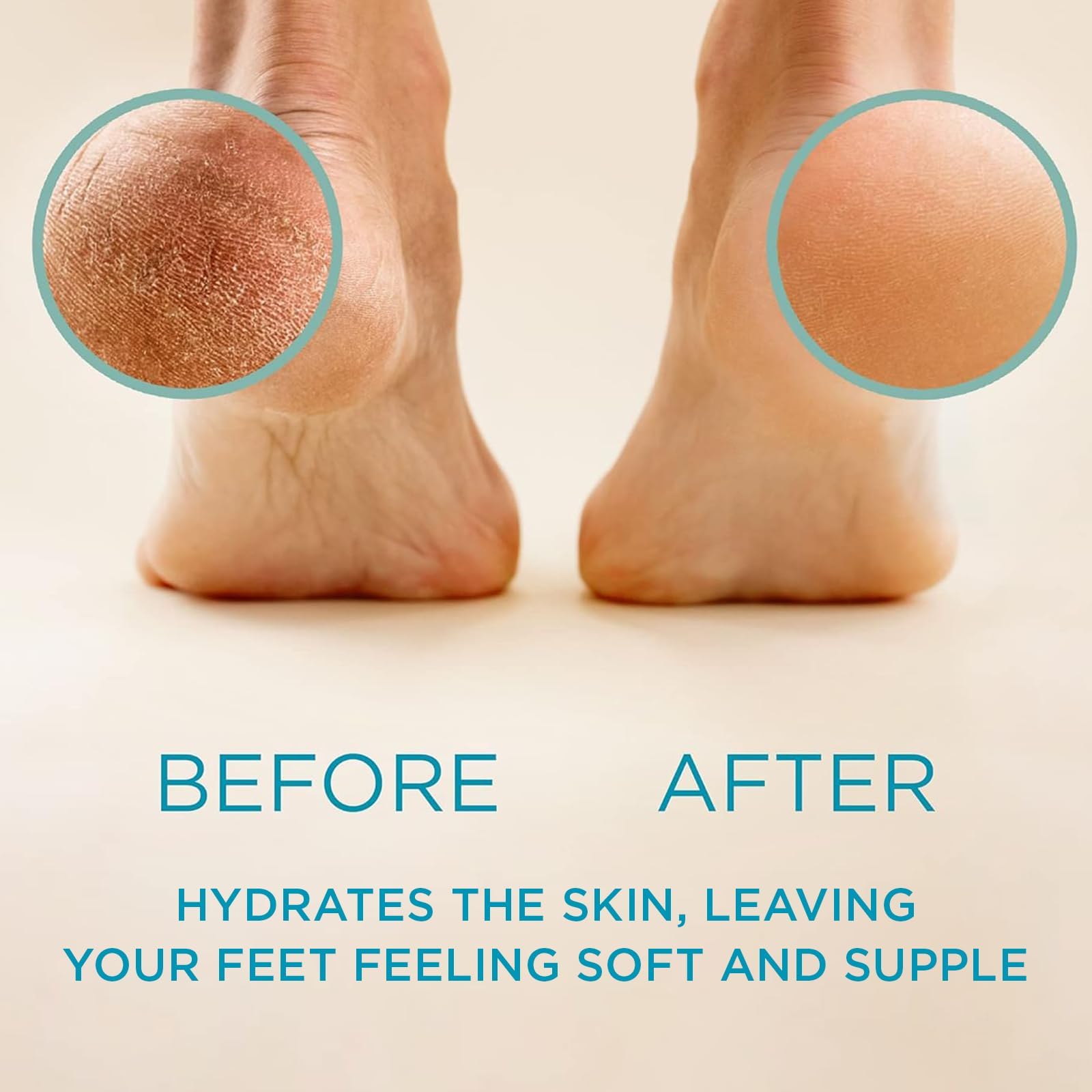 Lee Beauty Professional Callus Remover for Feet - Original, Powerful Formulation - Extra Strength Gel, Home Pedicure Foot Spa Results - Cracked & Dead Dry Skin Supplies - 8 Oz - Medaid International