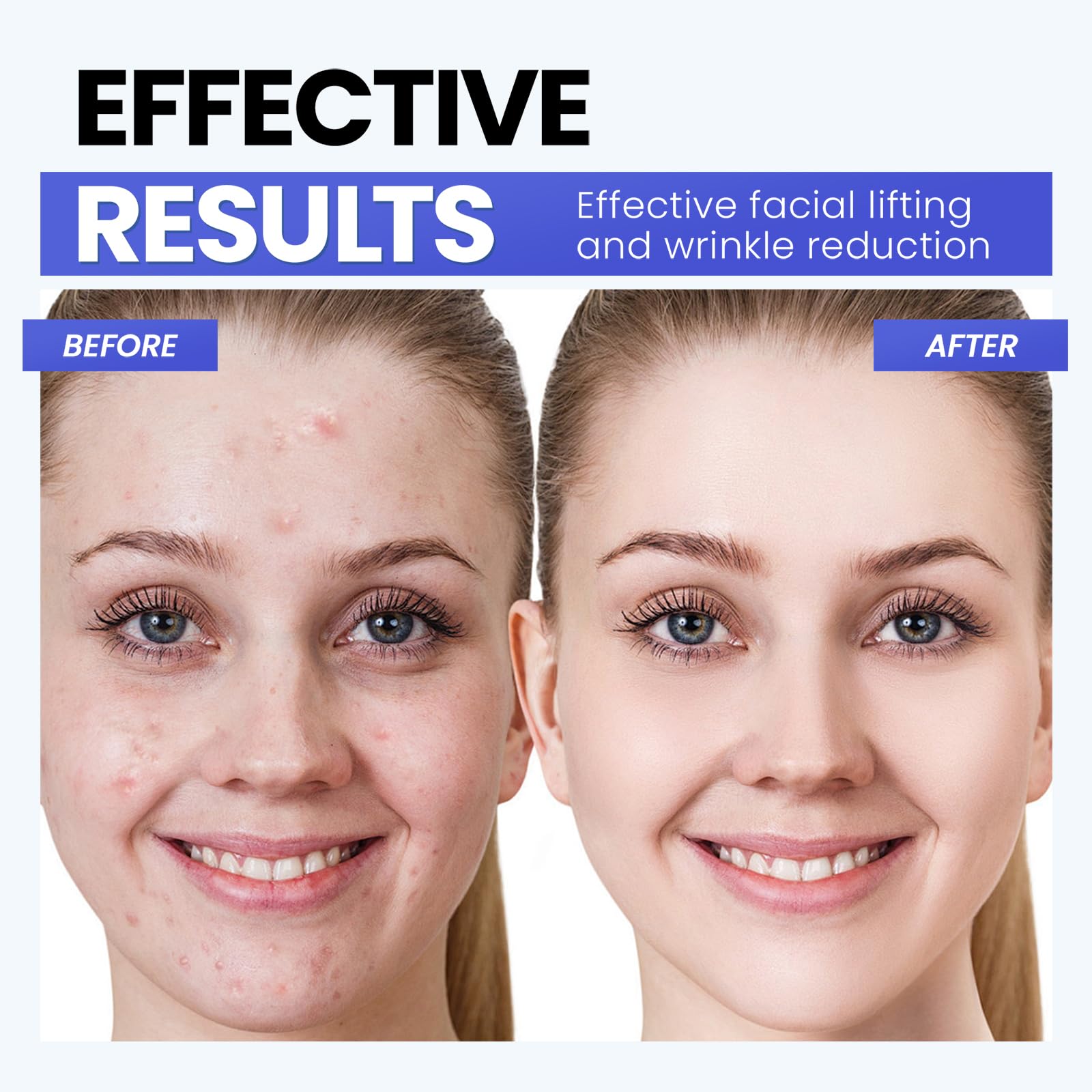 Gunfay Microcurrent Facial Device,Latest Red Light Technology,Enhances The Ability to Lift The Face and Tighten The Skin,USB Red Light Device for Face,for Facial Wrinkle Equipment, standard, White - Medaid International