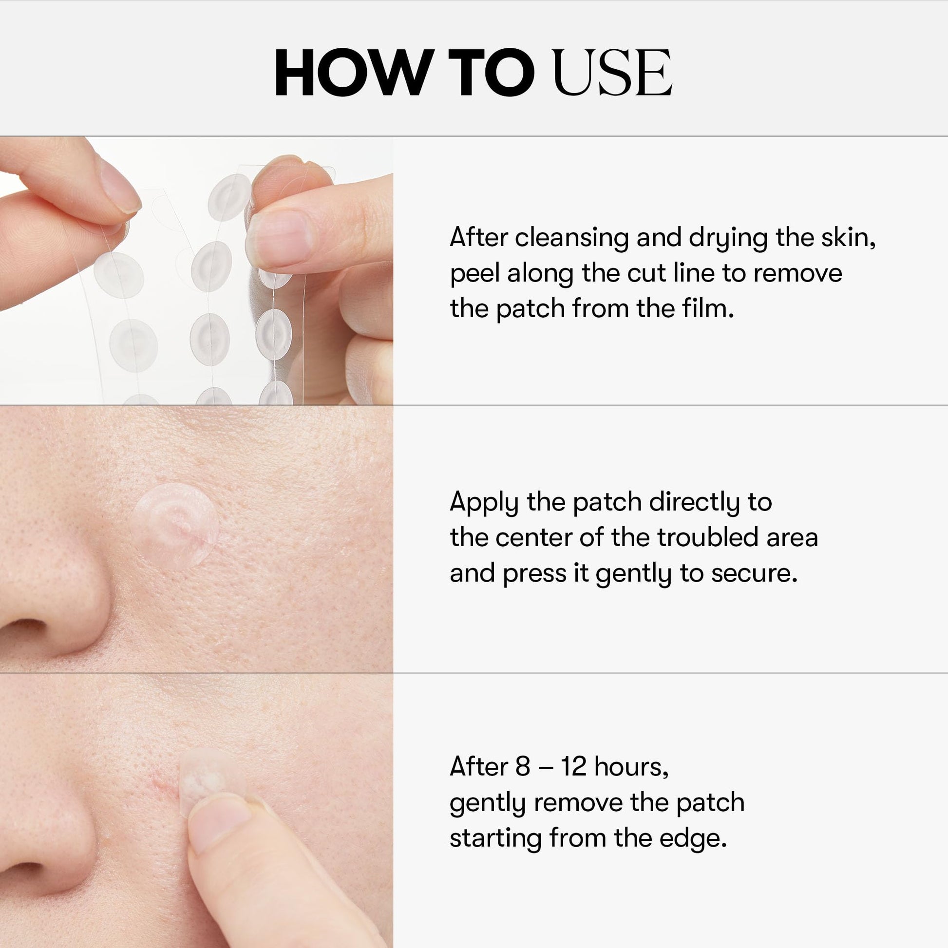 VT COSMETICS Garlic AC Reedle Shot Spot Patch (48 Patches) - Medaid International