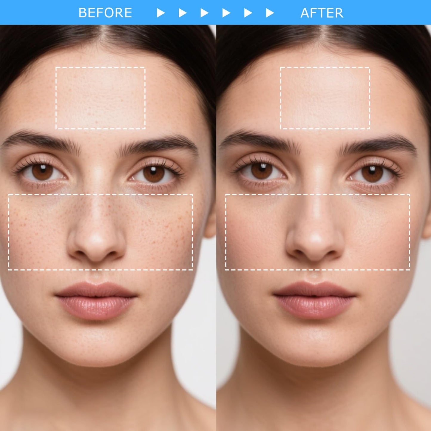 ISHERBIN 𝐶𝑒𝑛𝑡𝑒𝑙𝑙á Sunscreen SPF 50, Hyalu Cica Water-Fit Sun Serum, Face Sun Screen Long-Lasting Protection, Cen-tella Madagascar Sunscreen, NO White Cast - Dry Oily Korean Skincare (Blue 1) - Medaid International