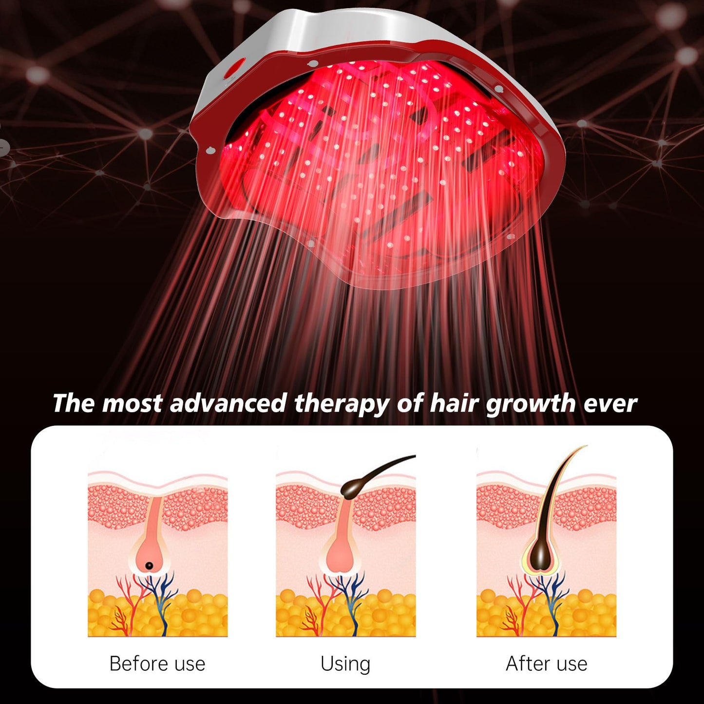 Hair Growth Device,LED Light Therapy Cap,Red Light Cap,Hair Regrowth Treatment for Men and Women - Medaid International
