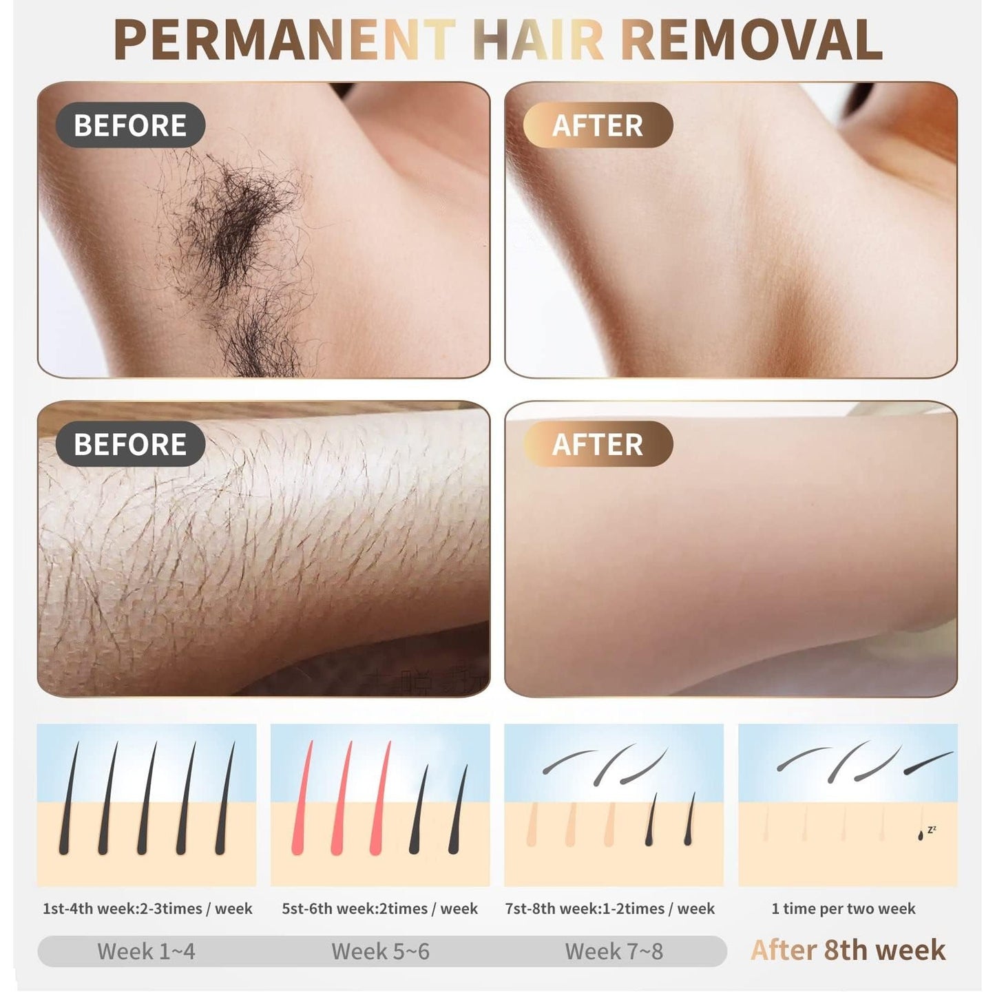 Laser Hair Removal Device Home Use IPL Laser Beauty Device Laser Hair Removal for Women and Men Hair Remover with Painless Permanent for Whole Body,Facial Lip Bikini Line Armpit Back Leg Arm - Medaid International