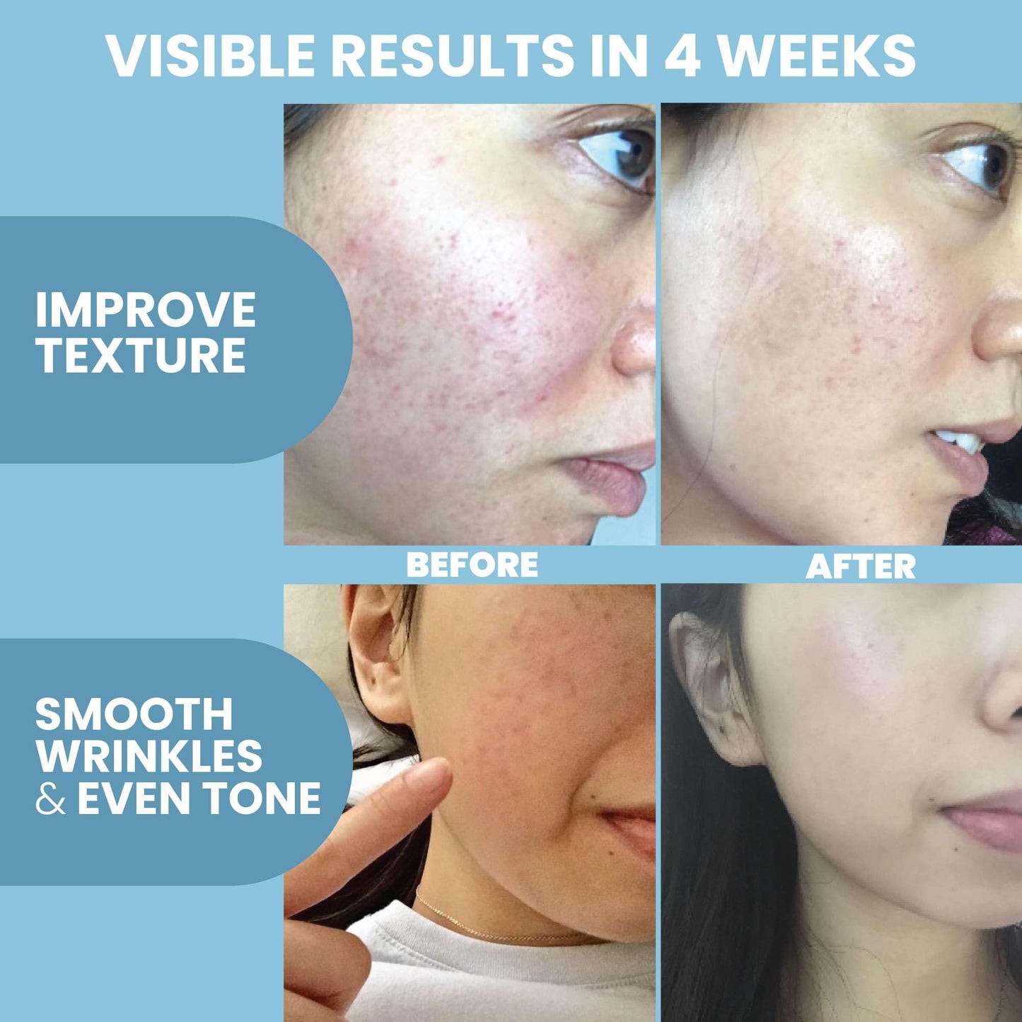 Collagen Peptide Serum for Face – Anti Aging Facial Treatment with Peptides & Hyaluronic Acid – Gentle Formula for Sensitive Skin, Microneedling Pen, Derma Roller, Skin Firming & Hydrating (2 Oz) - Medaid International