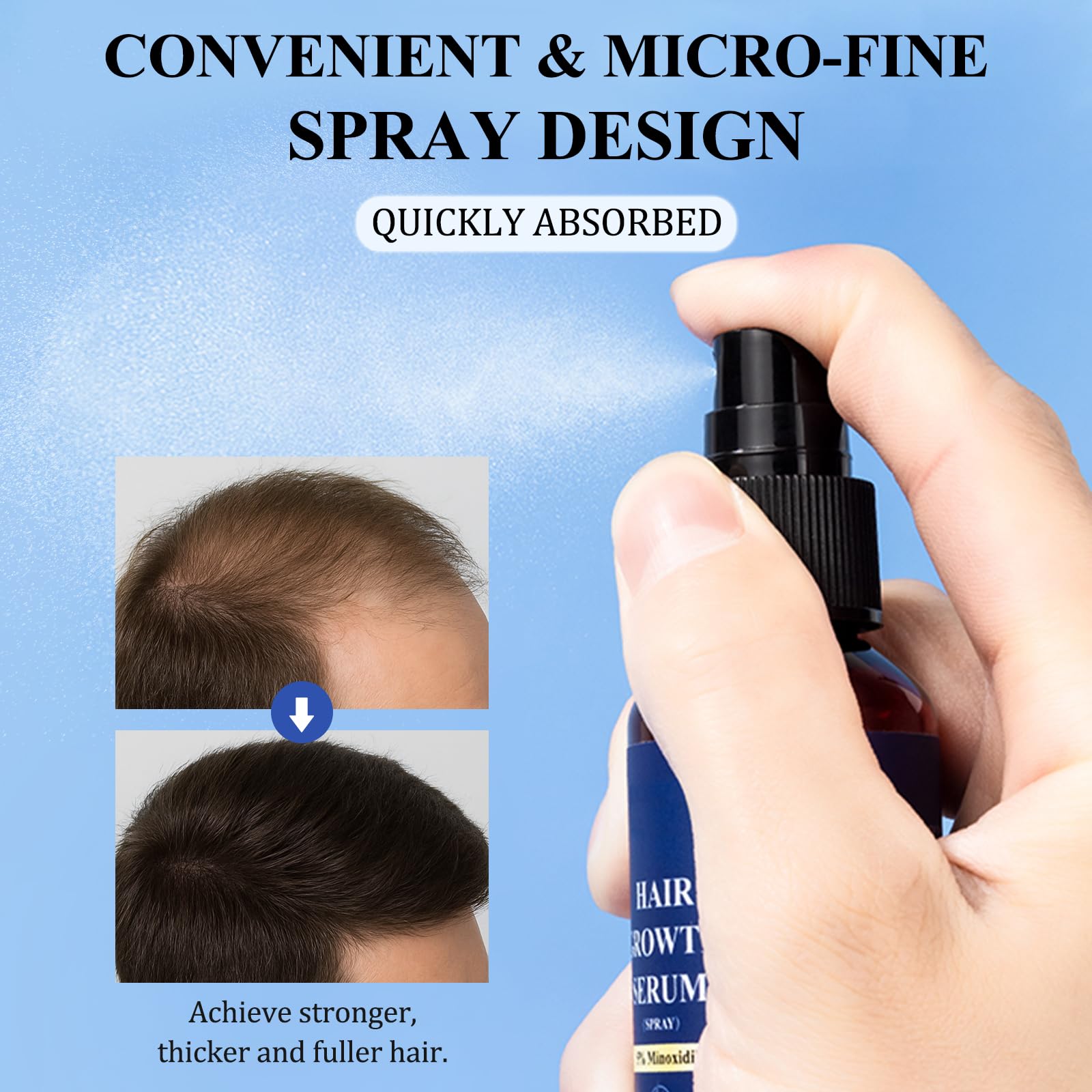 5% Minoxidil Hair Growth Spray - Minoxidil for Men and Women Hair Growth, Hair Regrowth Treatment for Stronger Thicker Hair (60ml) - Medaid International