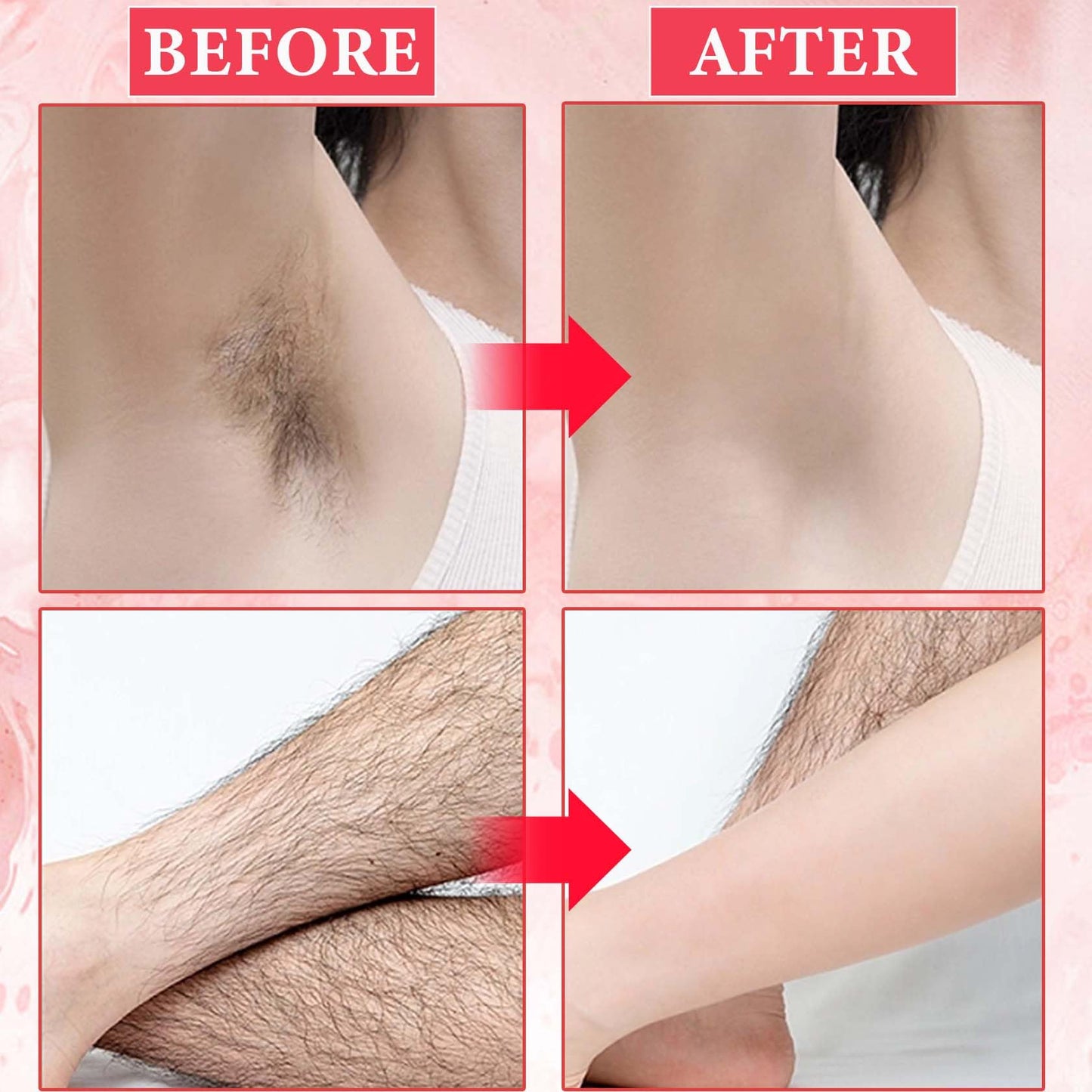 Cooling Gel for Hair Removal,Facial Gel Clear Coupling and Cooling Gel Use with Laser Hair Removal Device and Facial Body Skin Care Machine for Women & Men - Medaid International