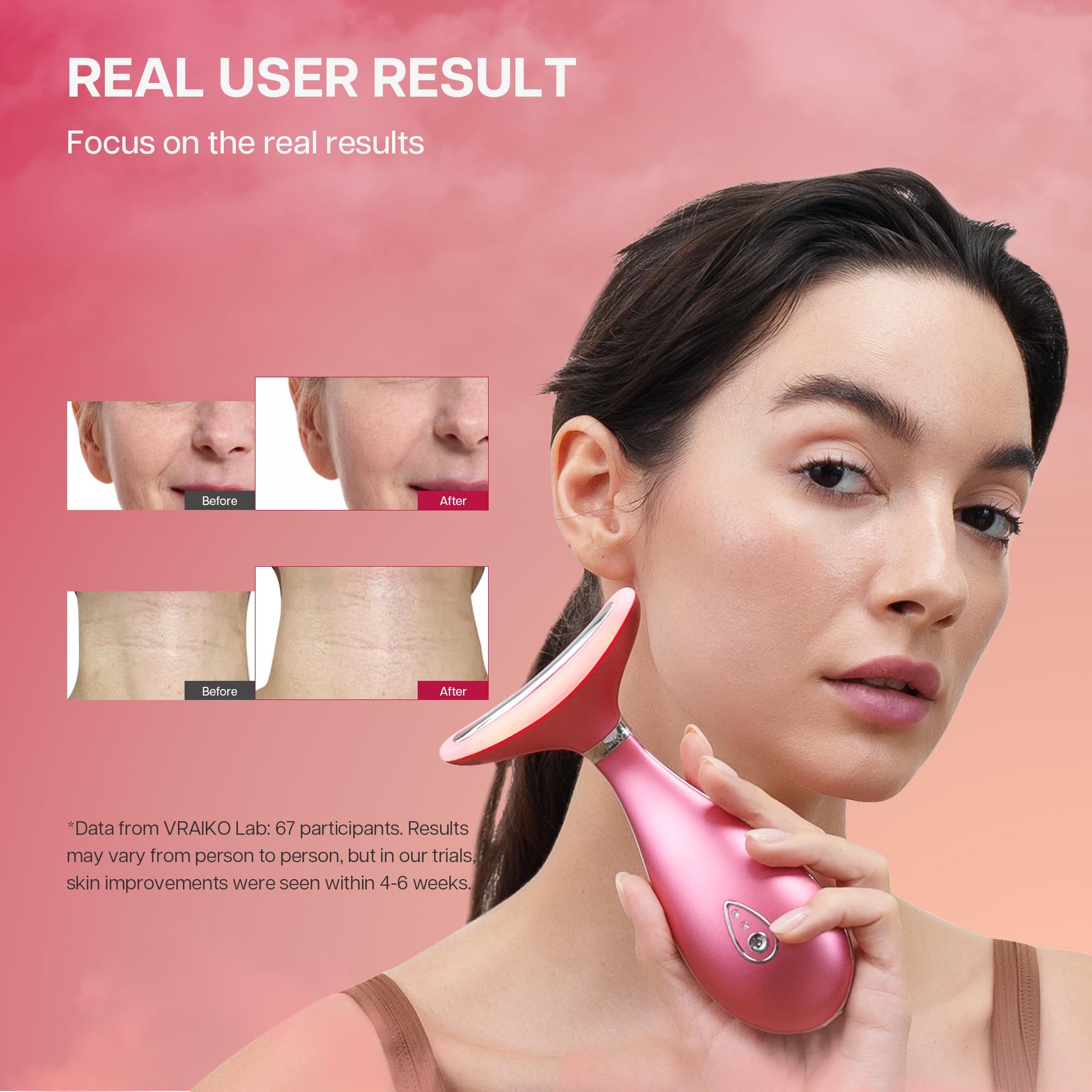 VRAIKO Lily Neck Face Massager, Face Sculpting Tool, 3-in-1 Facial Device with Thermal, Triple Action Care, for Enhanced Absorption Radiance Contouring Elasticity and Lymphatic Drainage (With Stand) - Medaid International