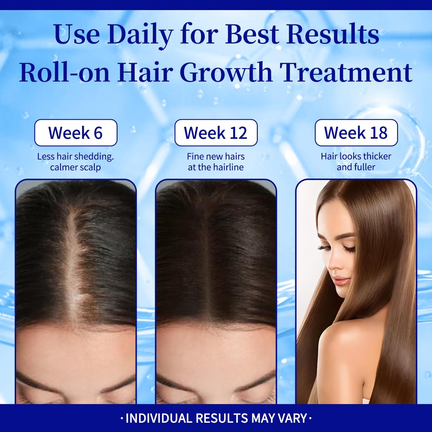 Hair Growth Roll-On Serum with Rosemary Oil & Redensyl - For Thicker Hair & Scalp Health - Lightweight Non-Greasy Treatment (01) - Medaid International