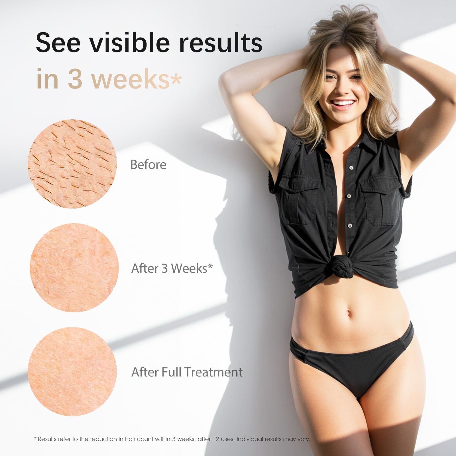 Laser Hair Removal, IPL Laser Hair Removal Device for Women & Men, Safe at-Home Nearly Painless 45°F Ice-Cooling Contact, Long-Lasting Result for Full Body & Face, Off-White - Medaid International