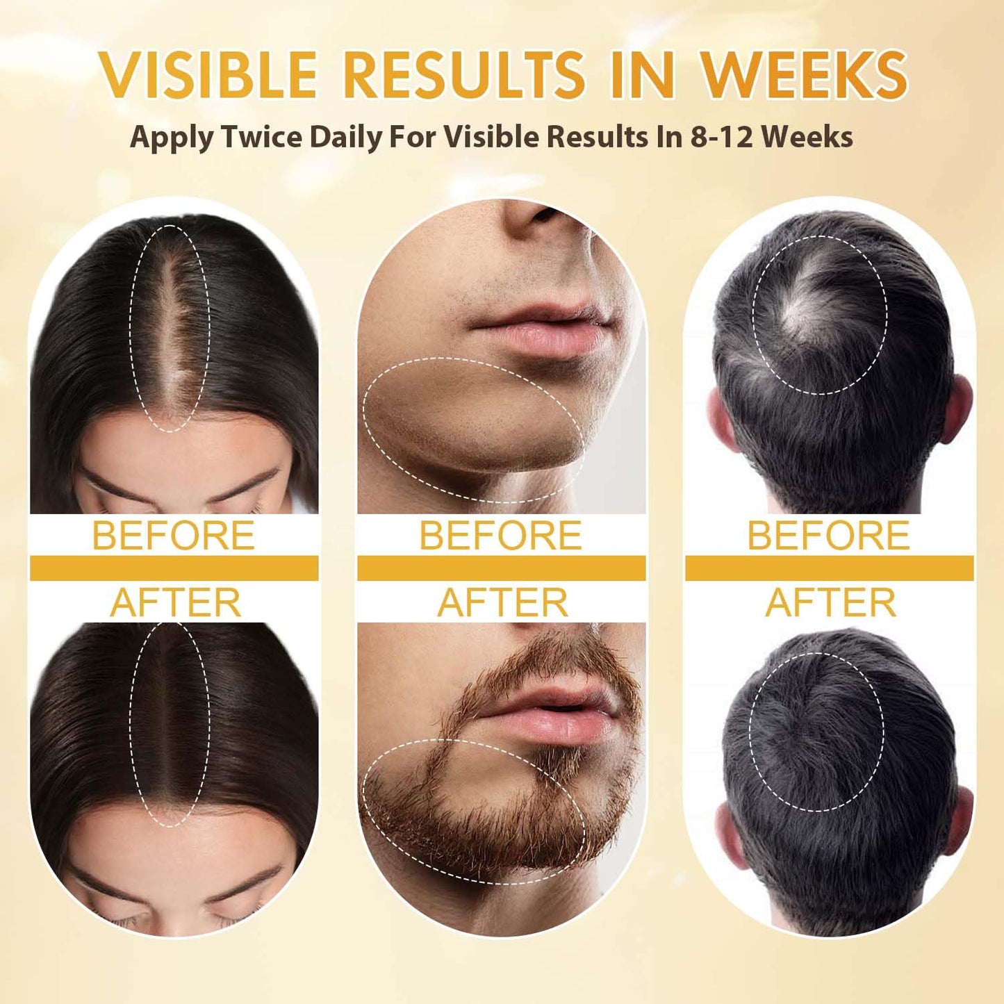 Minoxidil for Men and Women, Hair Growth Biotin Serum with Batana and Rosemary for Hair Beard Regrowth Treatments Extra Strength Hair Loss Solution, Clinically Proven to Regrow Thicker - Medaid International