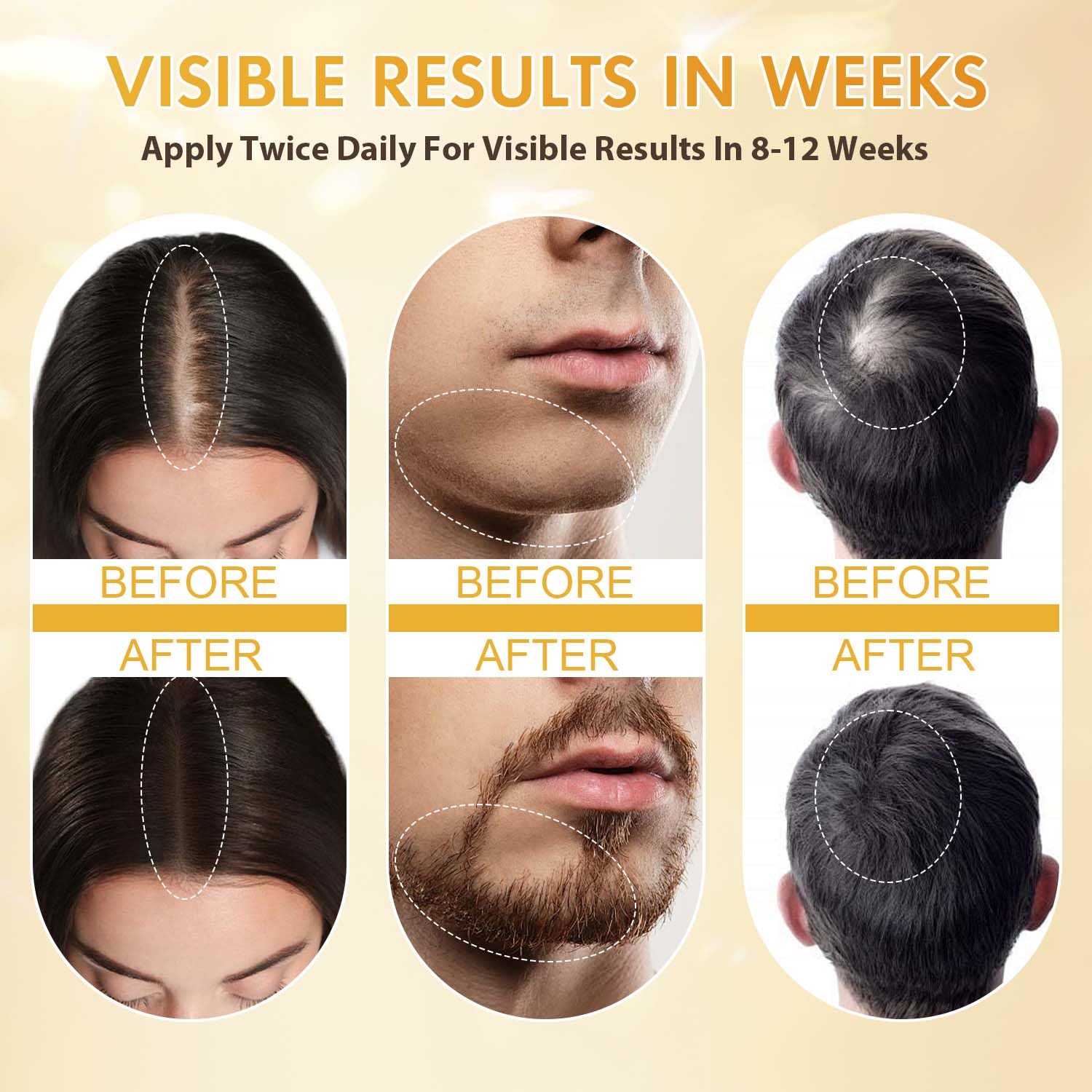 Minoxidil for Men and Women, Hair Growth Biotin Serum with Batana and Rosemary for Hair Beard Regrowth Treatments Extra Strength Hair Loss Solution, Clinically Proven to Regrow Thicker - Medaid International