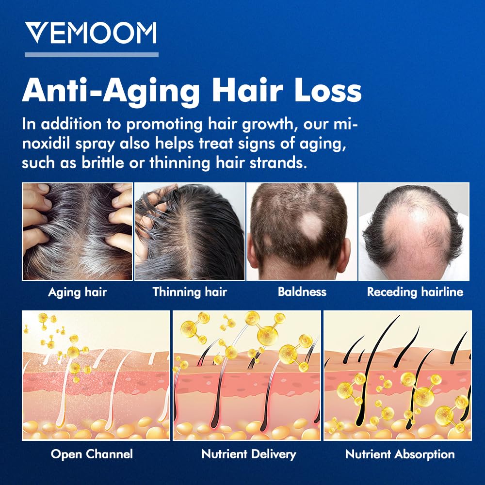 5% Minoxidil Hair Growth Spray for Women and Men, Effective Anti-Hair Loss Treatment for Regrowth, Extra Strength Scalp Solution, Thicker, Stronger and Longer Hair - 60ml*2 - Medaid International