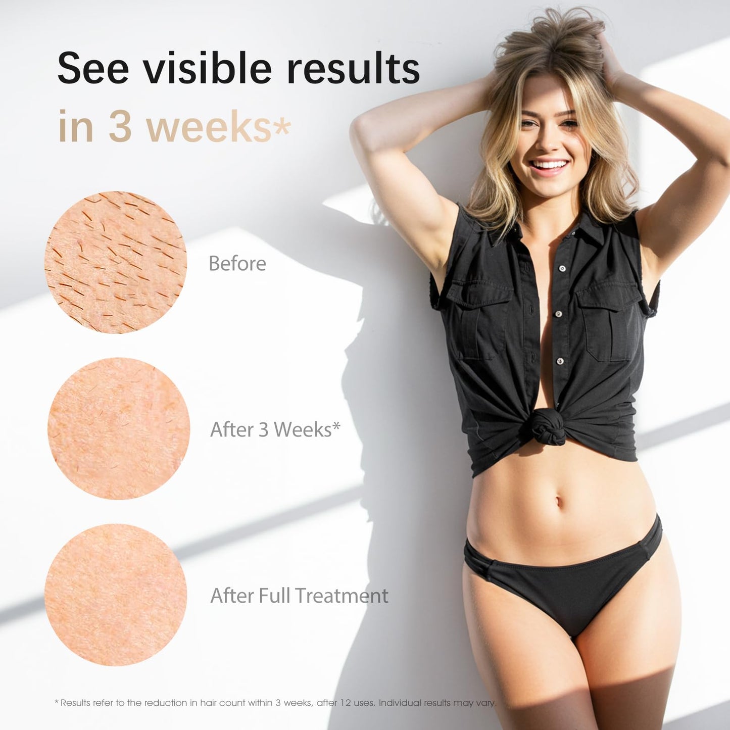 Laser Hair Removal, IPL Laser Hair Removal Device for Women & Men, Safe at-Home Nearly Painless 45°F Ice-Cooling Contact, Long-Lasting Result for Full Body & Face, Dark Green - Medaid International