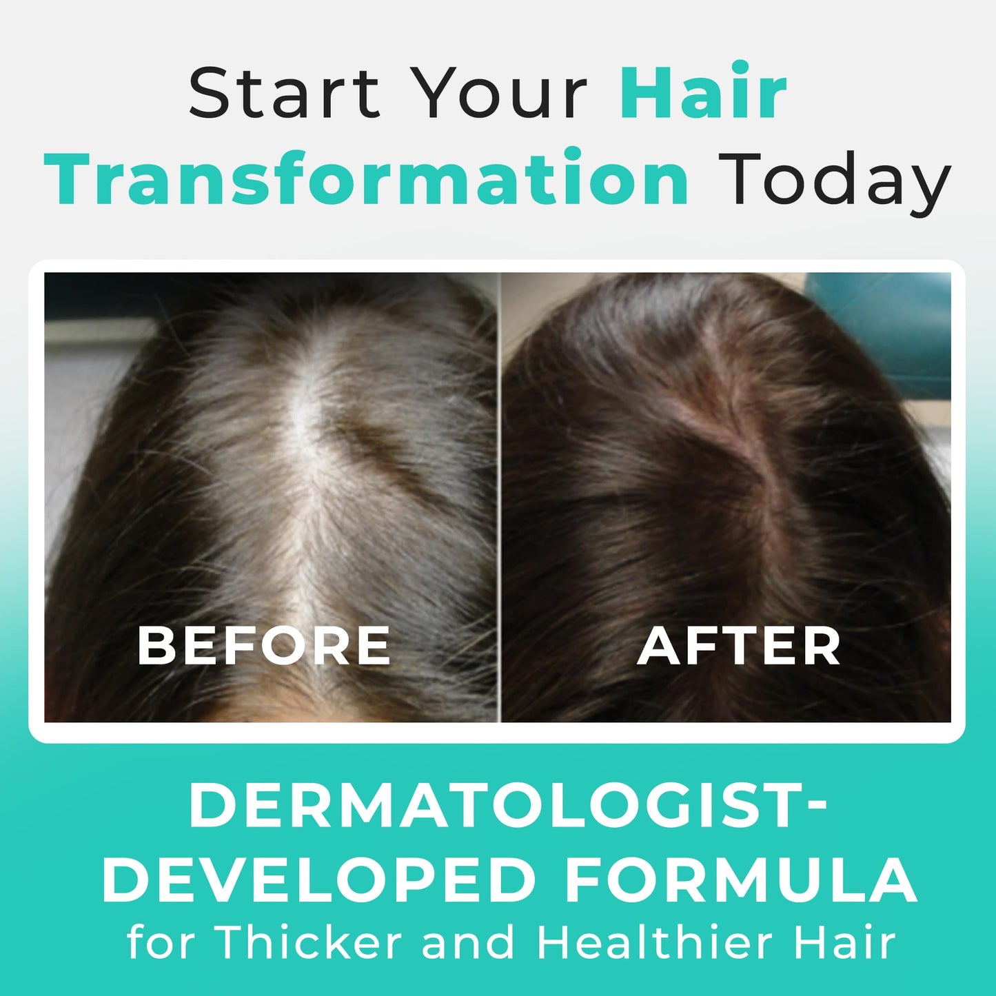 Hair Plus MD Hair Growth Supplement, 120 Capsules – Supports Hair Growth & Density – Dermatologist-Developed with Collagen & Vitamins – Gluten-Free, Toxin-Free, Non-GMO – 1 Month Supply - Medaid International