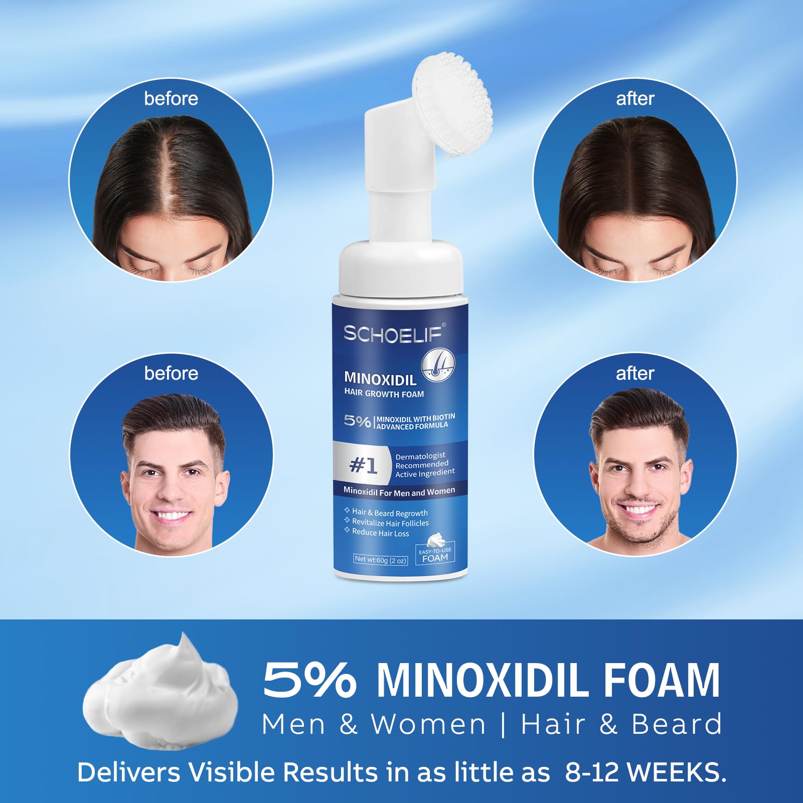 5% Minoxidil Foam 1PCS, Minoxidil for Men Foam, Minoxidil for Women Hair Growth, Minoxidil Foam for Men, Minoxidil Foam for Women. - Medaid International