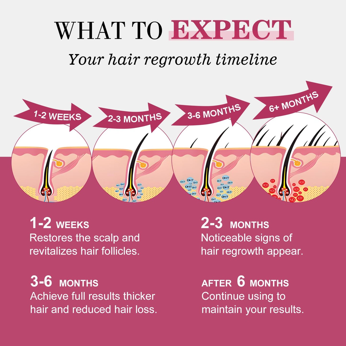 5% Minoxidil for Women Hair Regrowth Spray, hers hair regrowth treatment Infused with Biotin, Extra Strength Treatment to Combat Hair Loss and Thinning, 3 Bottles - Medaid International