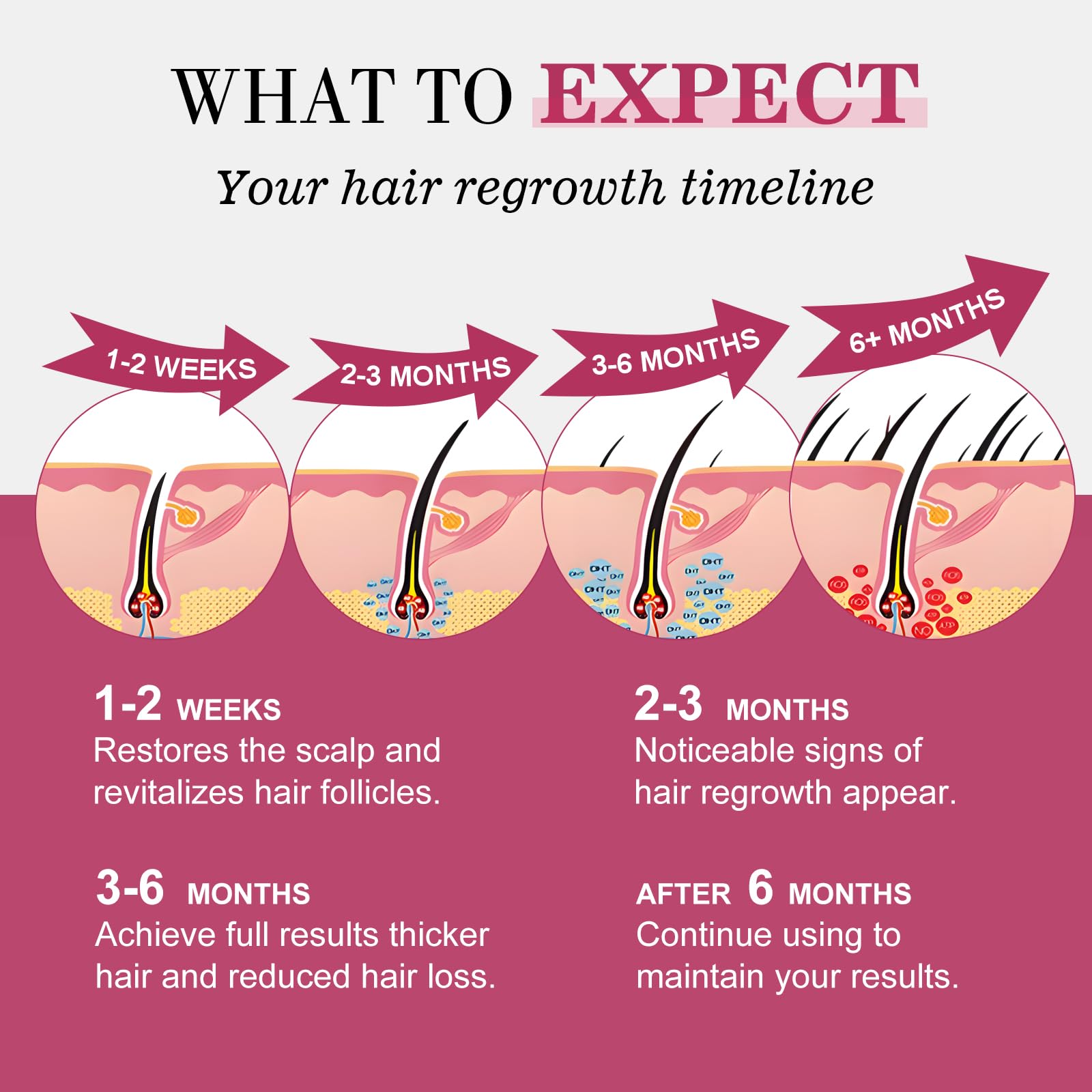 5% Minoxidil for Women Hair Regrowth Spray, hers hair regrowth treatment Infused with Biotin, Extra Strength Treatment to Combat Hair Loss and Thinning, 3 Bottles - Medaid International