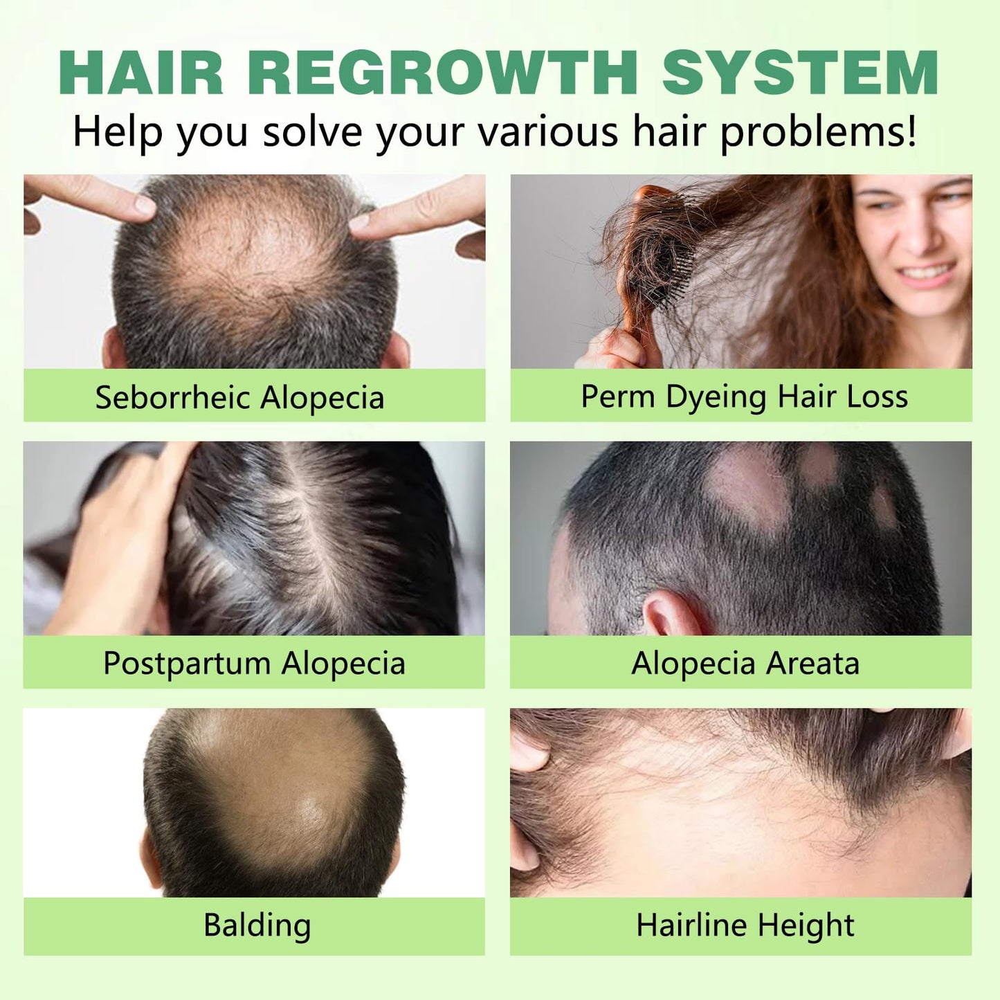 Hair Regrowth System, Advanced Hair Growth Treatment with Ginseng, Eclipta Prostrata, Peppermint Oil & Ginger Root,Hair Serum for Hair Growth,Hair Thickening Solution - Medaid International