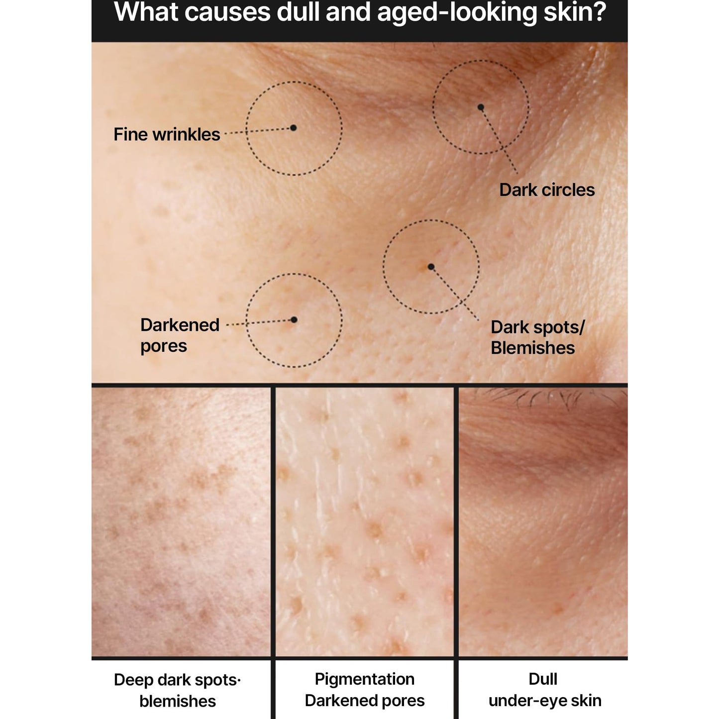 celimax Pore+Dark Spot Brightening Cream | with Niacinamide, Tranexamic Acid, TXA Cream, Pore Minimizer, Non-Irritating, Hydrating, For Sensitive Skin, 35ml - Medaid International