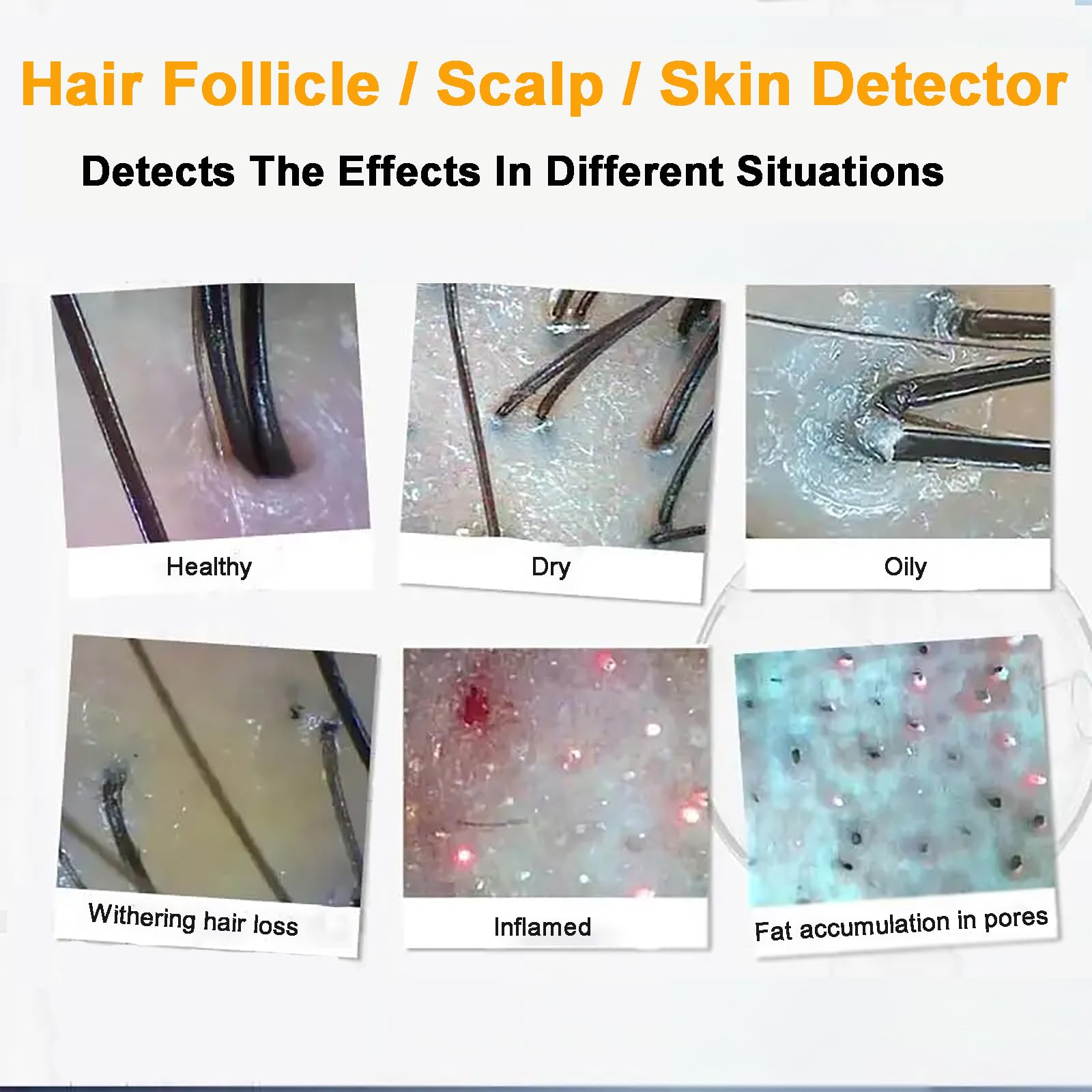 WGFXYBFY 5 in 1 Scalp Skin Hair Follicle Scalp Detector, Multifunction Hair Care Machine Hair Analyzer, 70X 200X Lens Scalp Health Detection for Home Salon Beauty Salon - Medaid International