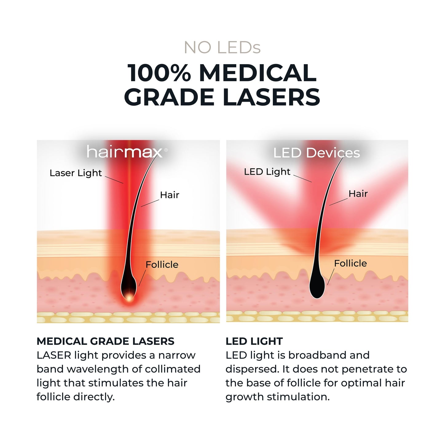 Hairmax Ultima 12 LaserComb - (FDA Cleared) Laser Hair Regrowth Treatment Device for Men & Women - Reverses Thinning Hair Loss - Red Light Therapy to Stimulate Hair Growth - Cordless Design - Medaid International