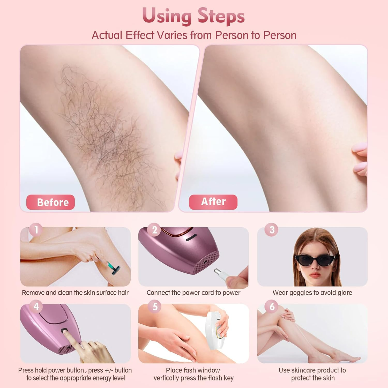 IPL Hair Removal Devices, Hair Removal, Laser Permanent Hair Removal, Laser Hair Remover, - Medaid International