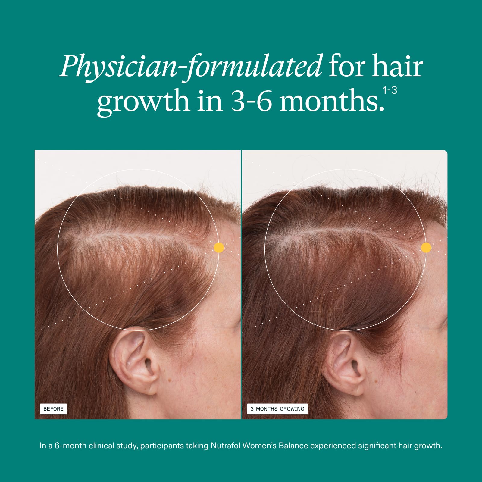 Nutrafol Women's Balance Hair Growth Supplements, Ages 45 and Up, Clinically Proven for Visibly Thicker Hair and Scalp Coverage in 3-6 Months, Dermatologist Recommended - 1 Month Supply Refill Pouch - Medaid International