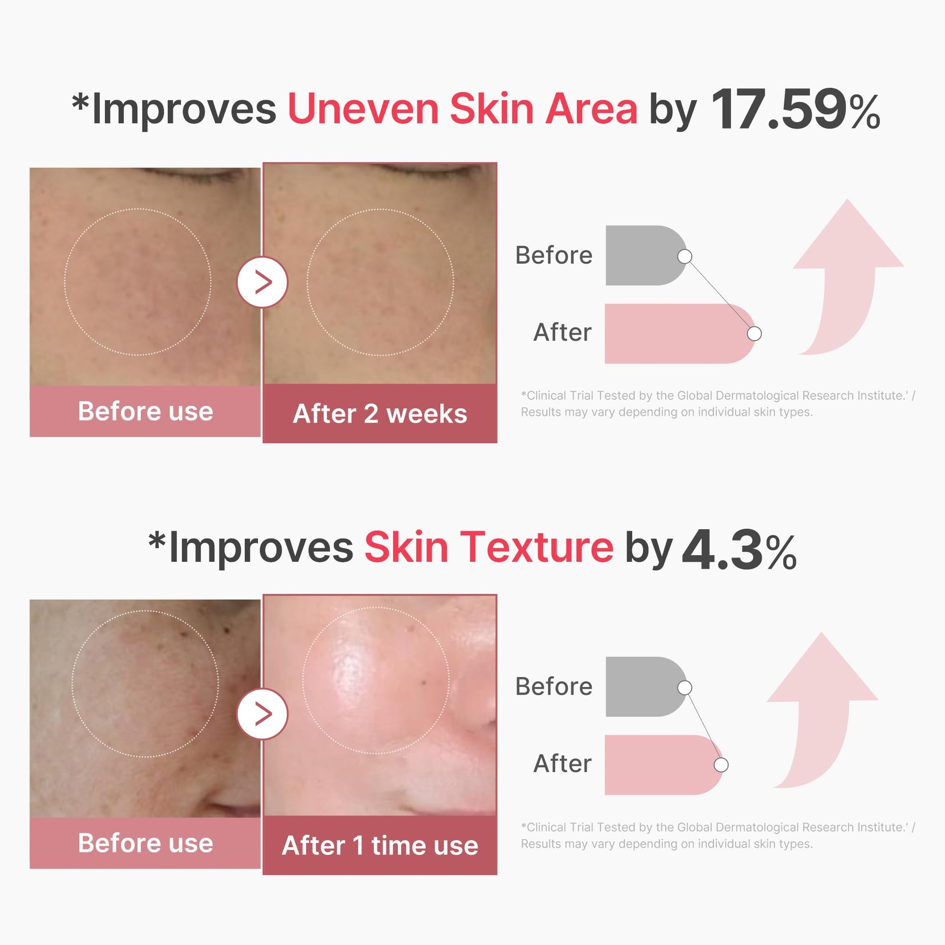 medicube PDRN Pink Collagen Exosome Shot Serum 2,000 PPM | Liquid Skin Booster | Exosome, Salmon DNA PDRN, Spicules | Uneven Skin Tone, Pore Care, Skin Texture | Korean Skin Care 1.01 fl.oz - Medaid International