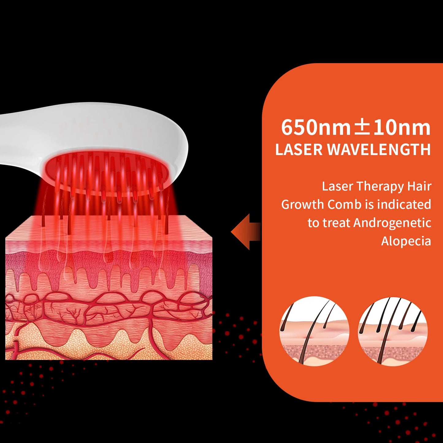 PUPCA Laser Therapy Hair Growth Comb, Hand-Held Comb-Shaped Low Level Laser Therapy To Promote Hair Growth in Women and Men - Medaid International