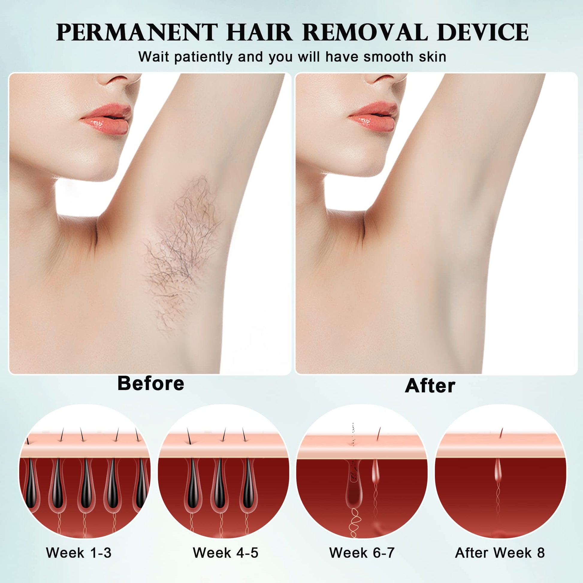 DEESS IPL Laser Hair Removal for Women & Men, GP590 Unlimited Flashes Laser Hair Removal Device with Ice Cooling, 3-in-1 at Home Painless Permanent Hair Remover for Face Arms Armpits Legs Bikini Body - Medaid International