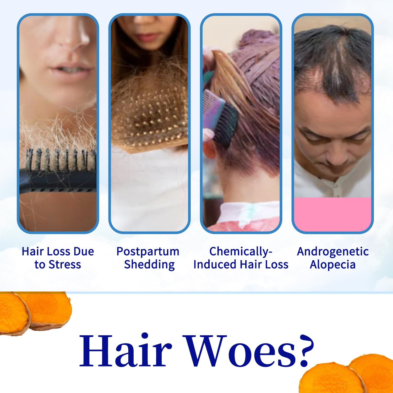 Hair Growth Roll-On Serum with Rosemary Oil & Redensyl - For Thicker Hair & Scalp Health - Lightweight Non-Greasy Treatment (01) - Medaid International