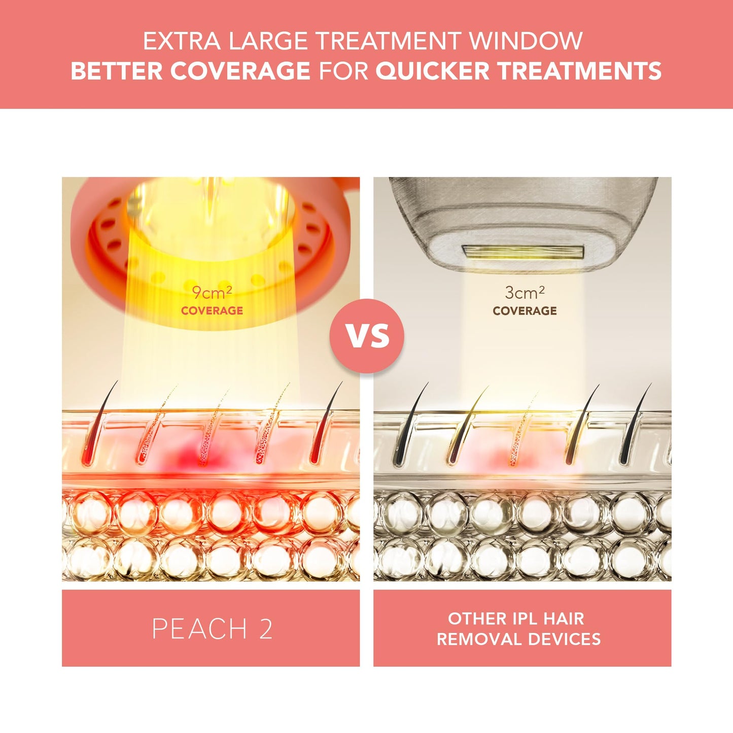 FOREO PEACH 2 IPL Hair Removal Device – Quick & Gentle Hair Reduction – For Full Body & Face – Skin Cooling System – Silicone Shield - Coral - Medaid International