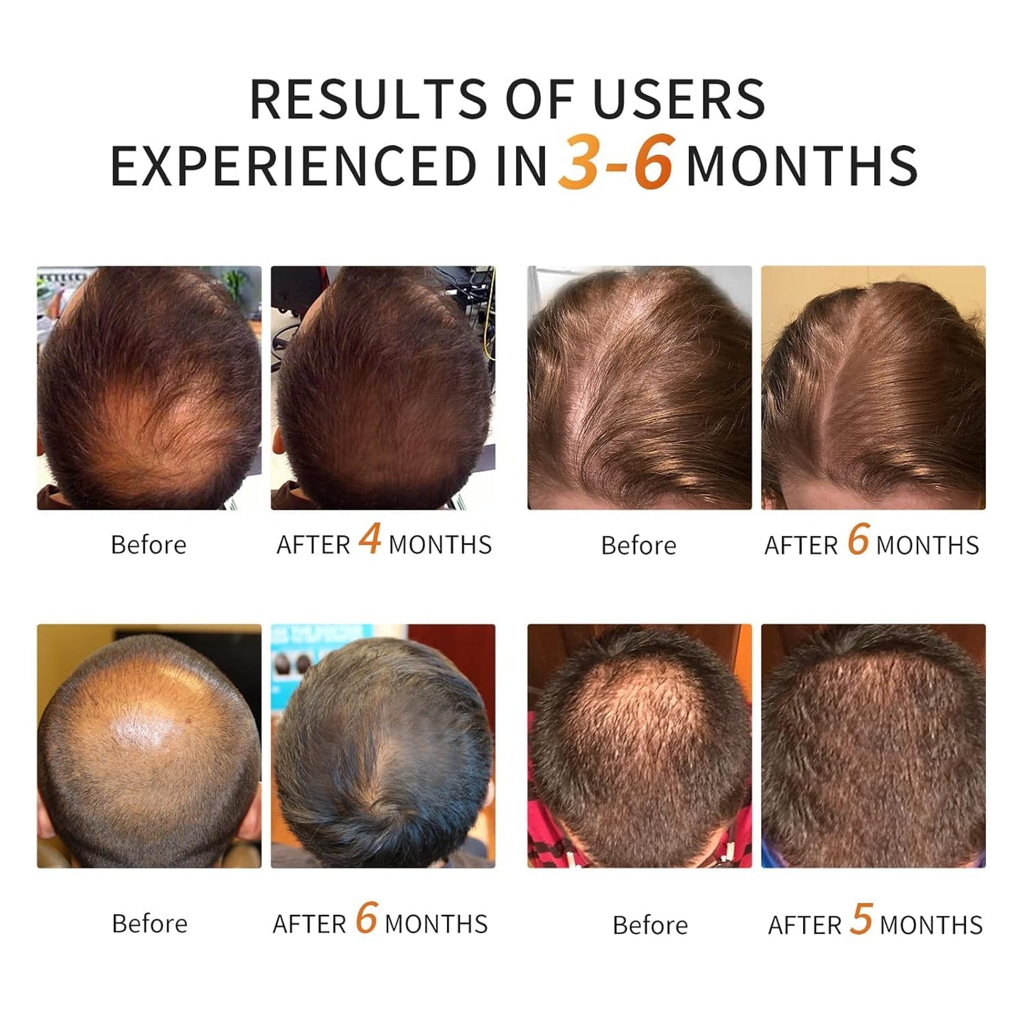 Irradiation Aesthetic Device Professional Hair Growth Laser Cap - FDA Cleared Low Level Laser Therapy Hair Regrowth for Men & Women, Hair Loss Treatment for Androgenetic Alopecia - Medaid International