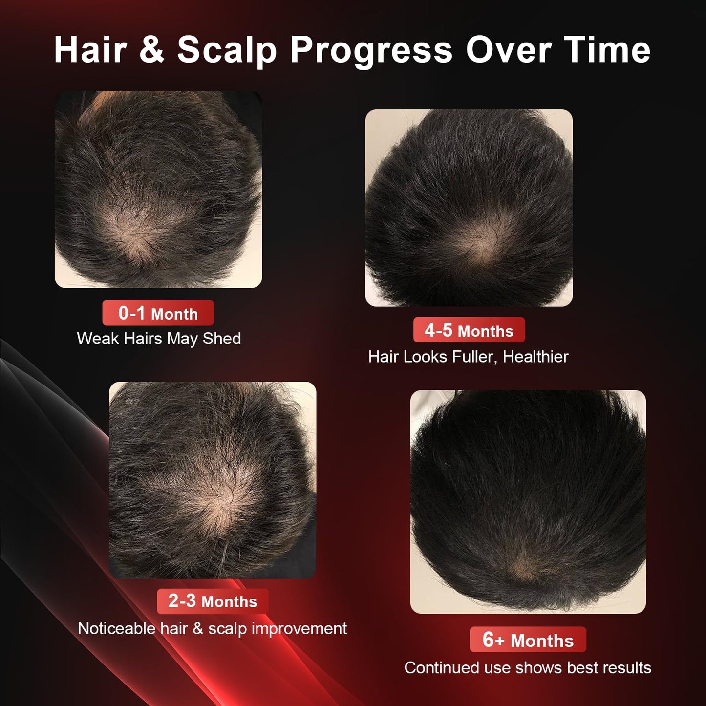 CAYAMA Red Light Therapy Cap for Hair – 510 LED Laser Hair Cap for Fuller, Healthier-Looking Hair, Rechargeable Light-Based Care Device for Men & Women - Medaid International