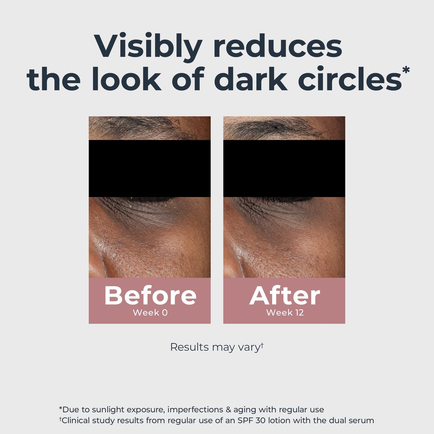 Eucerin Radiant Tone Eye Cream Dark Circle Corrector, Eye Brightening Cream with Thiamidol and Hyaluronic Acid, Helps Reduce the Look of Eye Puffiness, 0.5 Oz Tube - Medaid International