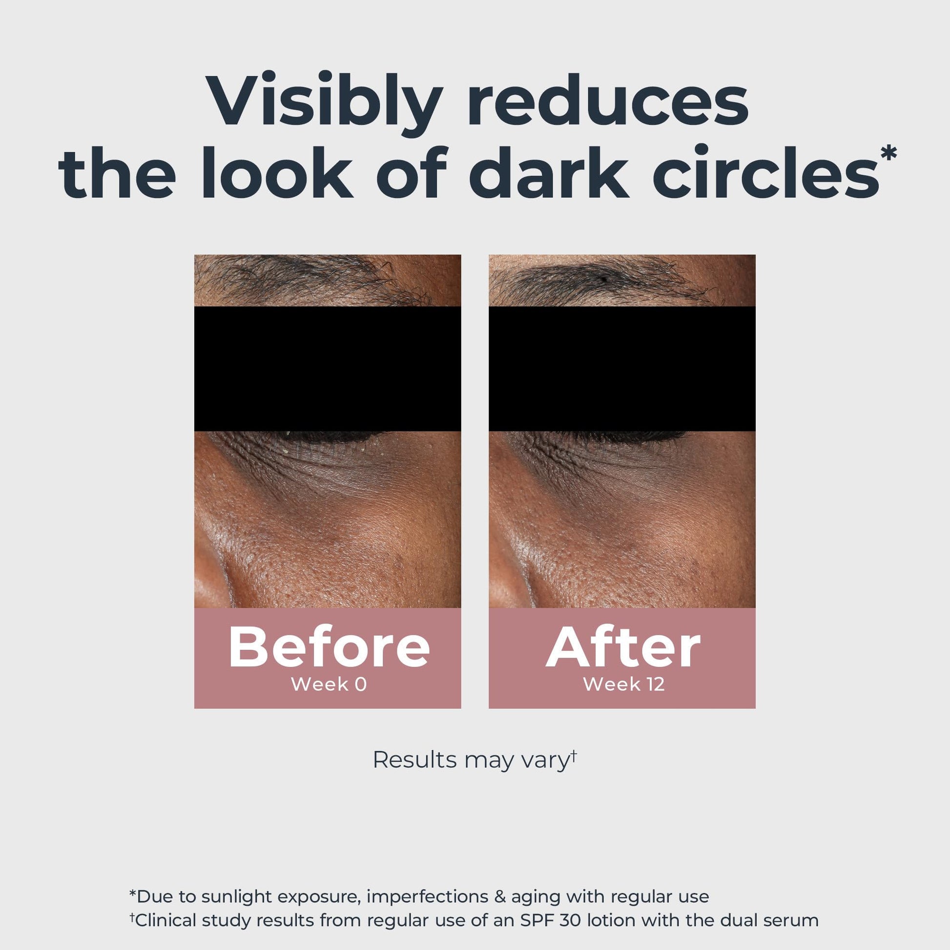 Eucerin Radiant Tone Eye Cream Dark Circle Corrector, Eye Brightening Cream with Thiamidol and Hyaluronic Acid, Helps Reduce the Look of Eye Puffiness, 0.5 Oz Tube - Medaid International