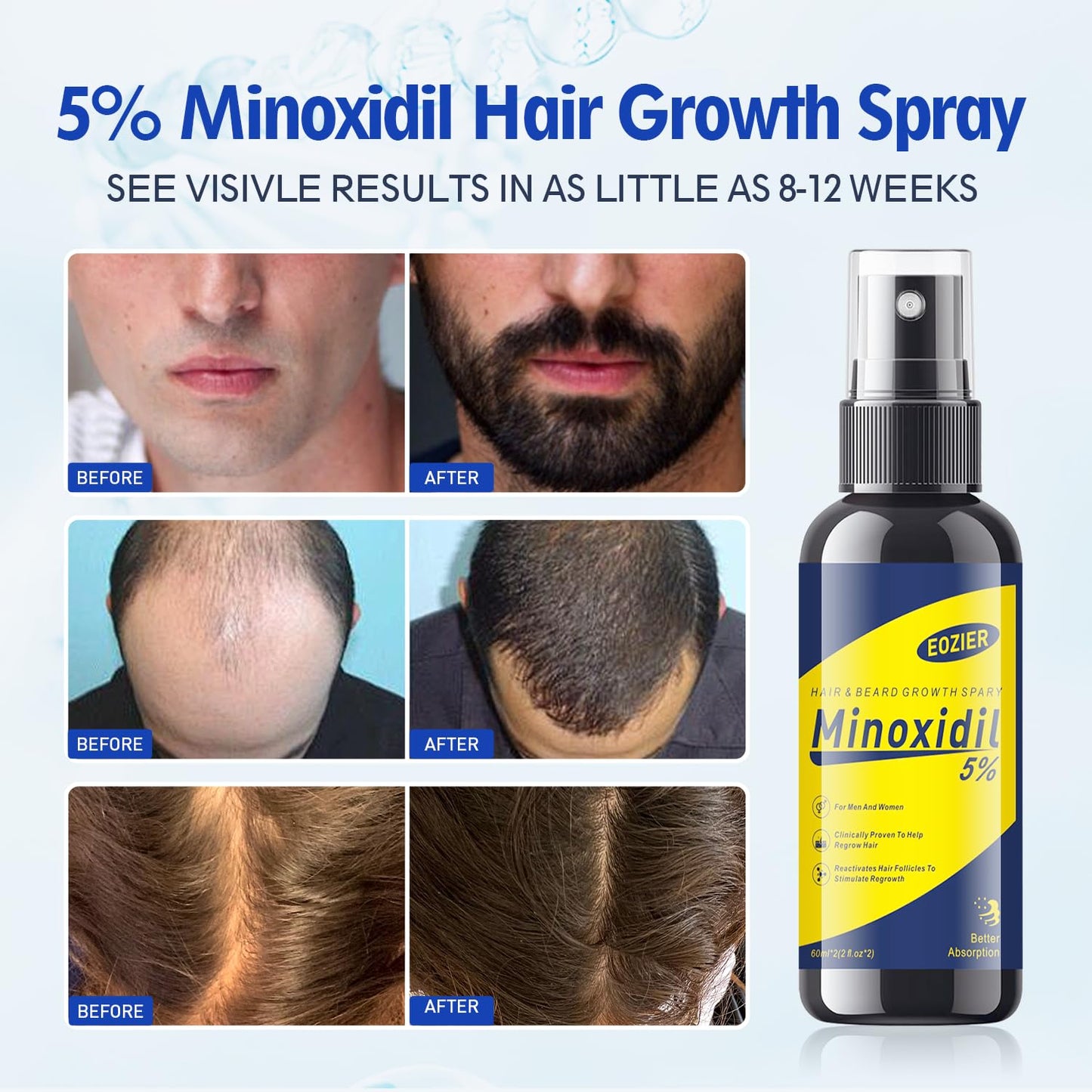 5% Minoxidil with Biotin, Hair Loss Treatments for Women Men Hair Regrowth Treatment, Minoxidil Spray Hair and Beard Mustached Growth Serum Oil, Improves Appearance of Thinning Hair,4 FL OZ/120mL - Medaid International