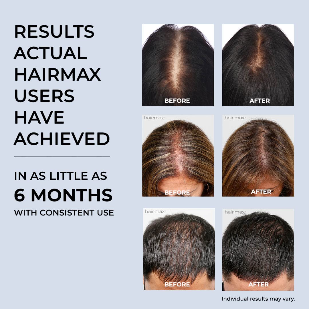 HairMax Laser Band 41 - (FDA Cleared) Hair Growth Device - Restores Natural Hair Cycle with Red Light Therapy - Medaid International