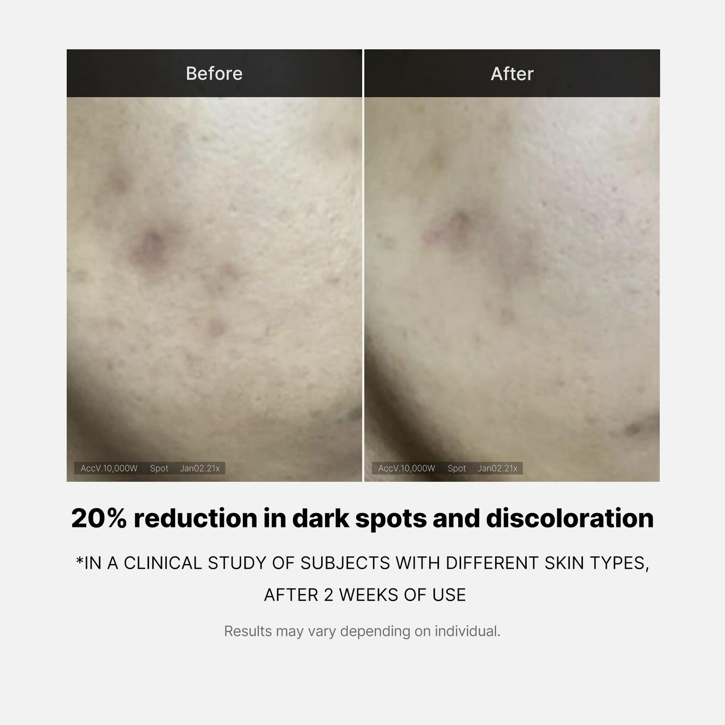 Medicube Deep Vita C Serum 2.0 || 14.5% Pure Vitamin C reduce the appearance of hyperpigmentation, dark spots, and blemishes | 16 self-tests complete | Korean skincare (10g * 3 bottles) - Medaid International