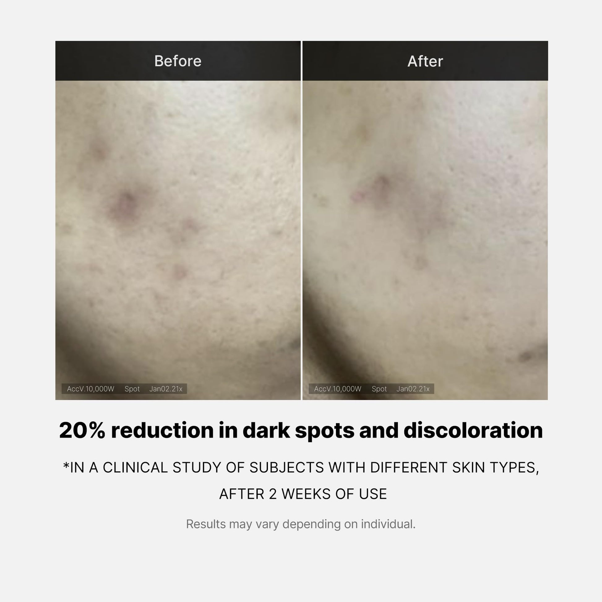 Medicube Deep Vita C Serum 2.0 || 14.5% Pure Vitamin C reduce the appearance of hyperpigmentation, dark spots, and blemishes | 16 self-tests complete | Korean skincare (10g * 3 bottles) - Medaid International