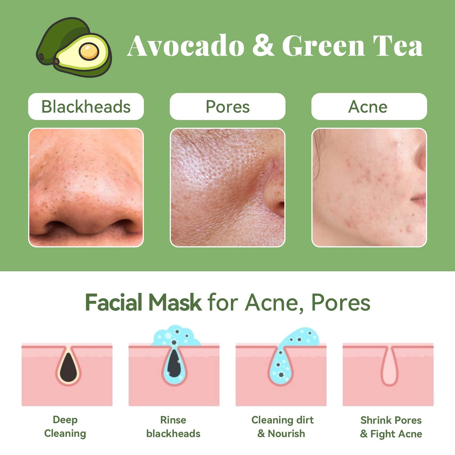 ANAI RUI Green Tea Face Mask with Avocado, Clay Facial Mask for Acne, Detox, Face Cleansing Mask, Hydrating, Nourishing, Soothing, 120g/4.23 oz - Medaid International