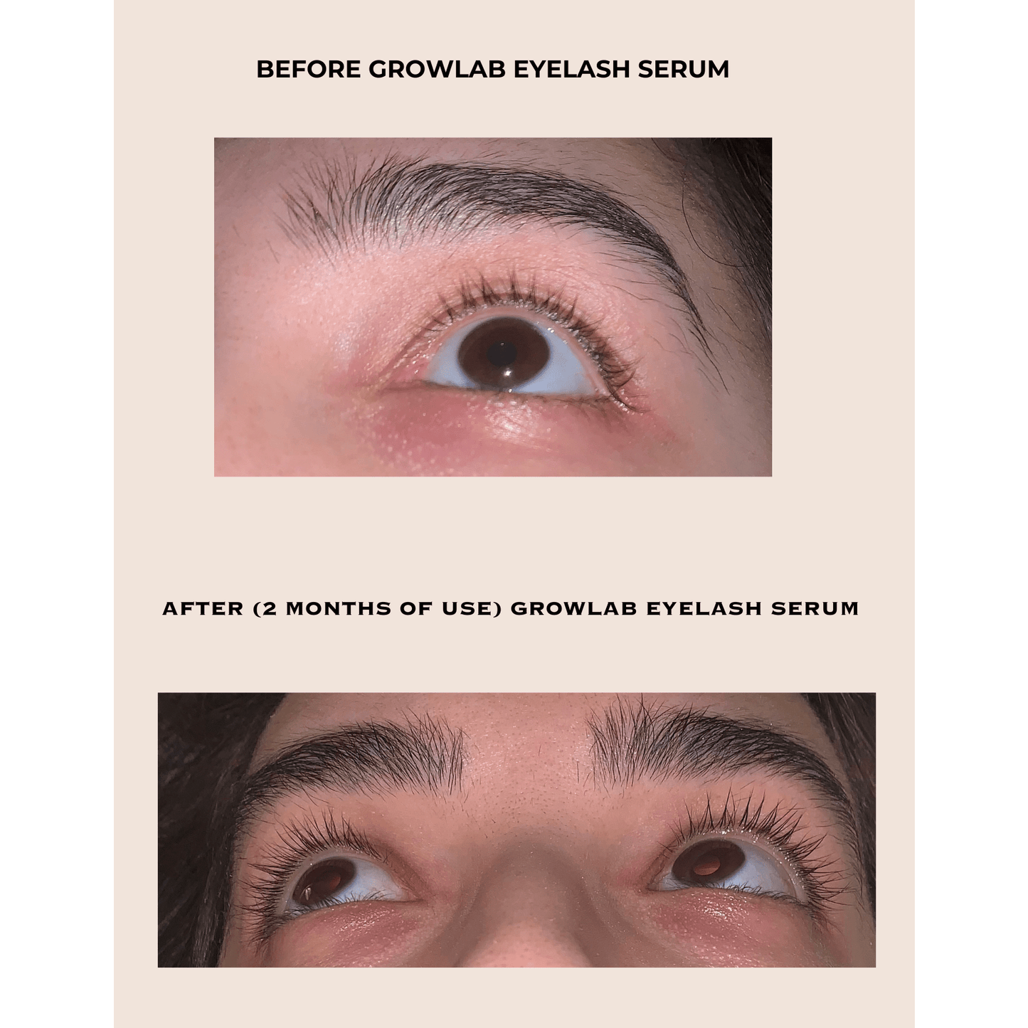 GROWLAB Eyelash Serum - Medaid