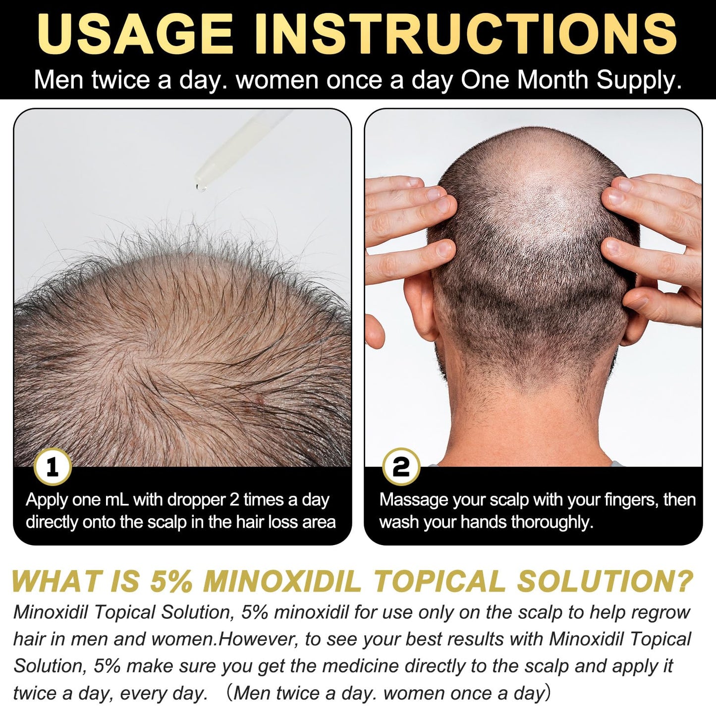 5% Minoxidil for Men and Women Hair Growth Serum, Biotin Hair Growth, Hair Regrowth Treatment for Scalp Hair Loss Hair Thinning for Thicker Longer Fuller Healthier Hair (Pack of 1) - Medaid International