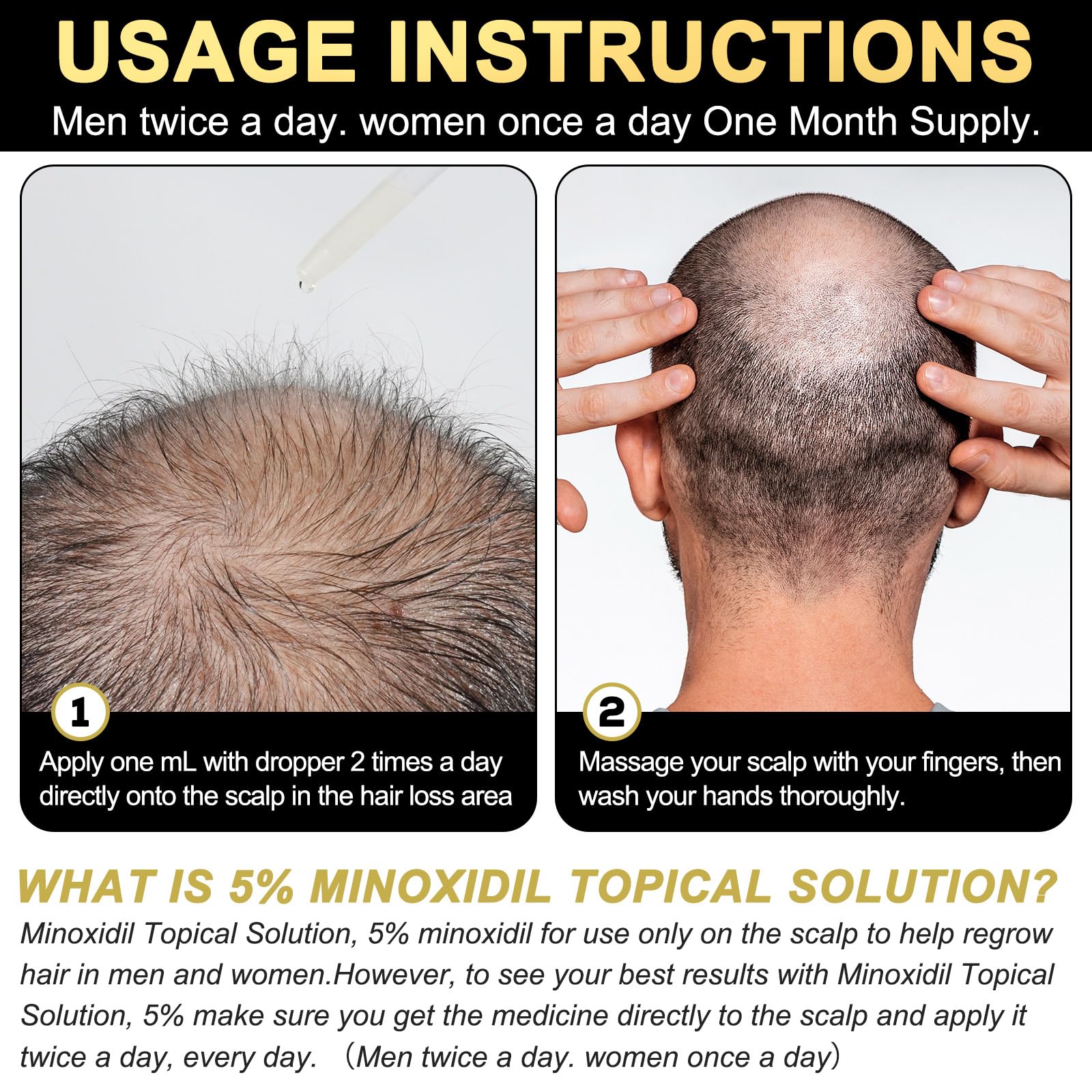 5% Minoxidil for Men and Women Hair Growth Serum, Biotin Hair Growth, Hair Regrowth Treatment for Scalp Hair Loss Hair Thinning for Thicker Longer Fuller Healthier Hair (Pack of 1) - Medaid International