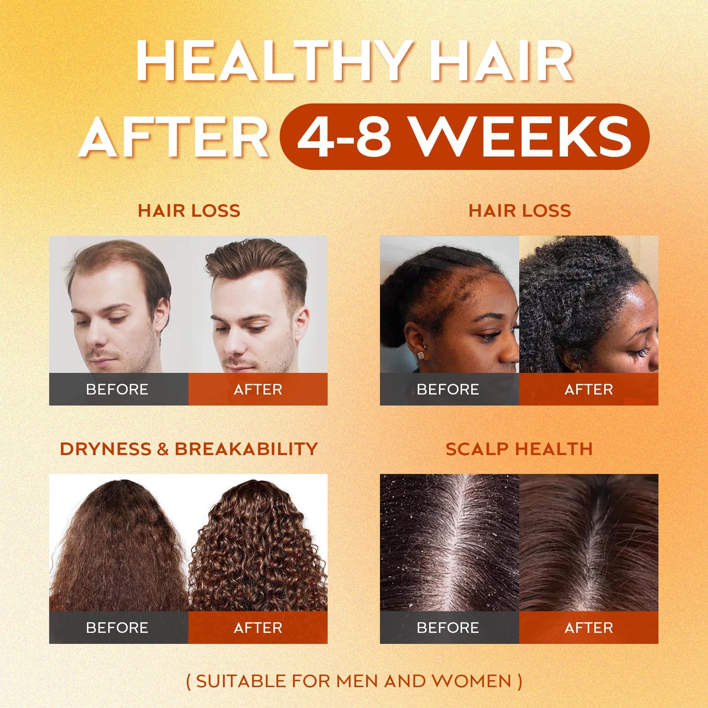 Batana Oil for Hair Growth Dr Sebi, 100% Raw Organic Batana Hair Mask from Honduras, Wild Growth Hair Oil, Scalp Oil Promotes Hair Thickness, Prevents Loss for Men & Women, 4.06 fl oz (1 Pack) - Medaid International