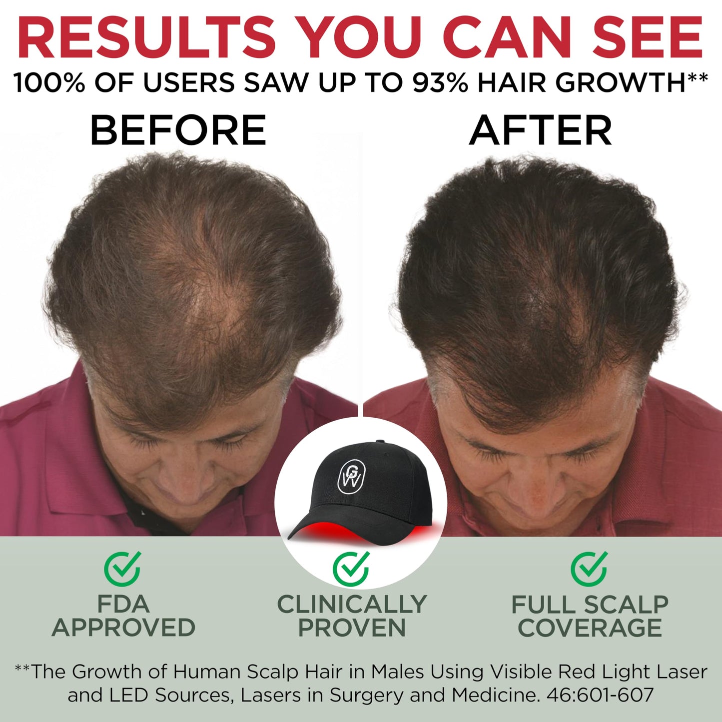 GroWell Red Light Therapy Hair Growth Cap – FDA Cleared Laser Treatment for Hair Regrowth and Reduced Shedding – LED & Laser Red Light Therapy Clinically Proven in Double-Blind Studies -Black - Medaid International