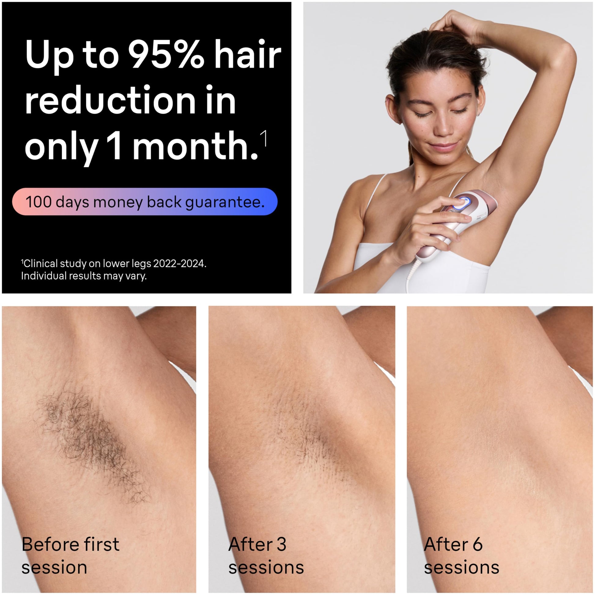 Braun Smart IPL, Skin i·Expert Pro 7: at Home Laser Hair Removal, Permanent Visible Hair Reduction, Holiday Gifts for Women and Men with Free App, Vanity Case, Venus Razor, 4 Smart Heads, IPL7387 - Medaid International