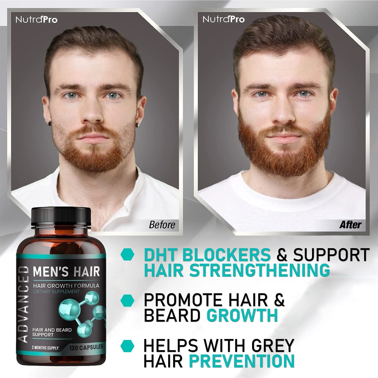 Hair Growth Vitamins For Men - Anti Hair Loss Pills. Regrow Hair & Beard Growth Supplement For Volumize, Thicker Hair.Stop Hair Loss And Thinning Hair With Biotin & Saw Palmetto Hair Vitamins.120 Caps - Medaid International
